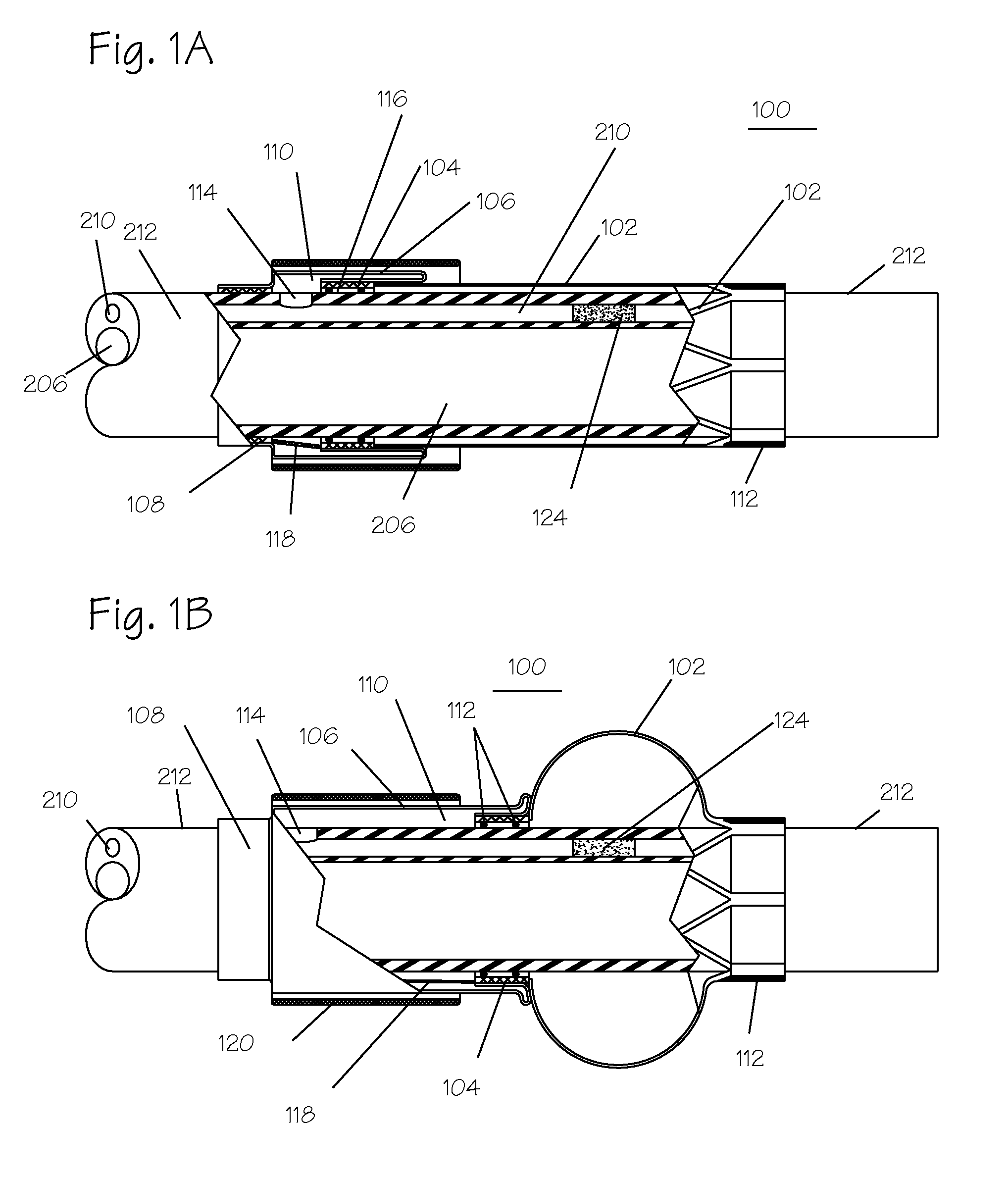 Pressure Activated Foreign Body Removal System and Method of Use