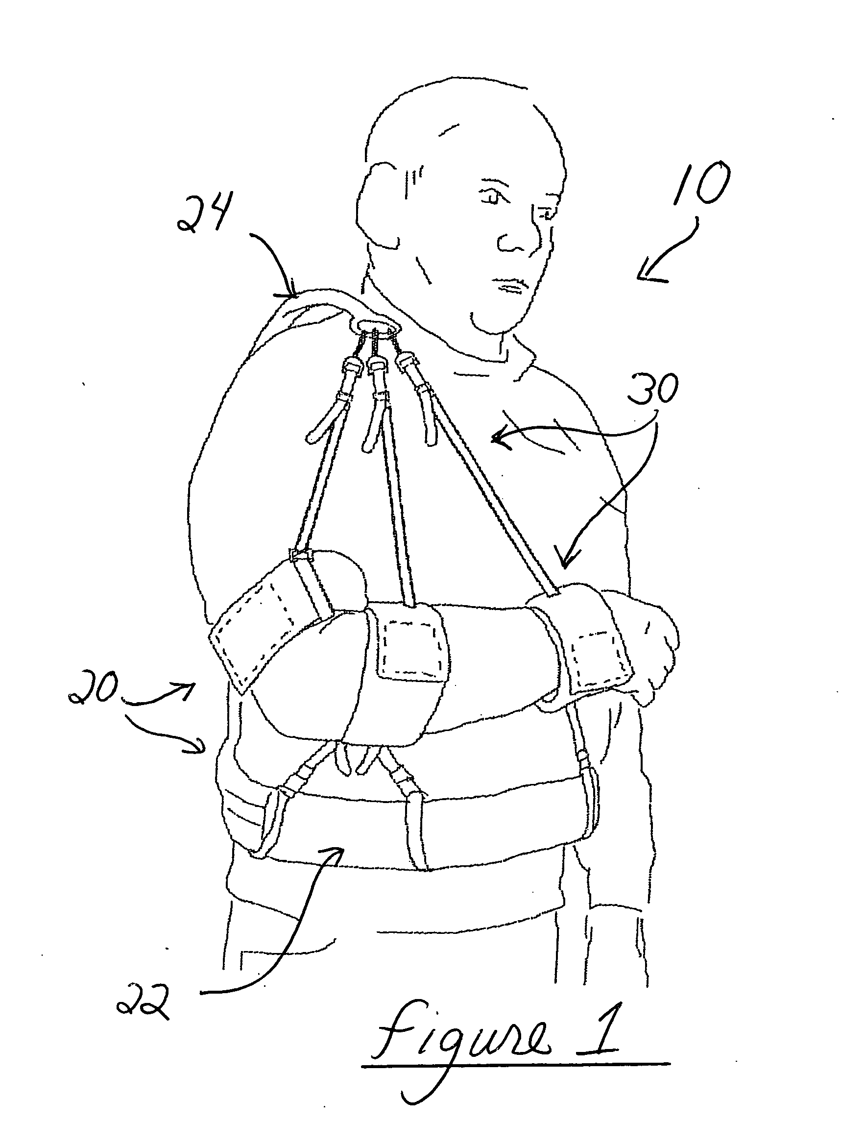 Arm sling apparatus allowing movement or total immobilization