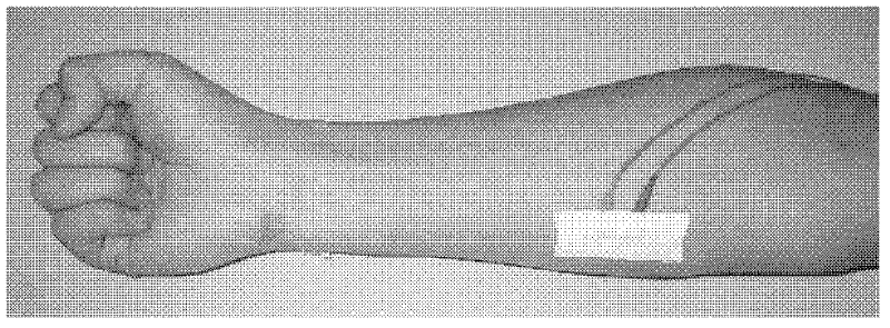 Synchronization likehood-based electroencephalograph and electromyography synergistic analyzing method