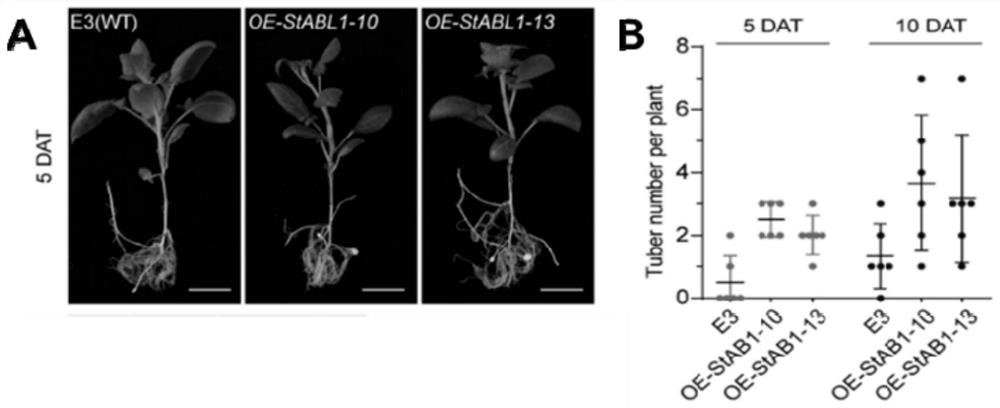 Application of potato StABL1 gene in regulation and control of potato maturity