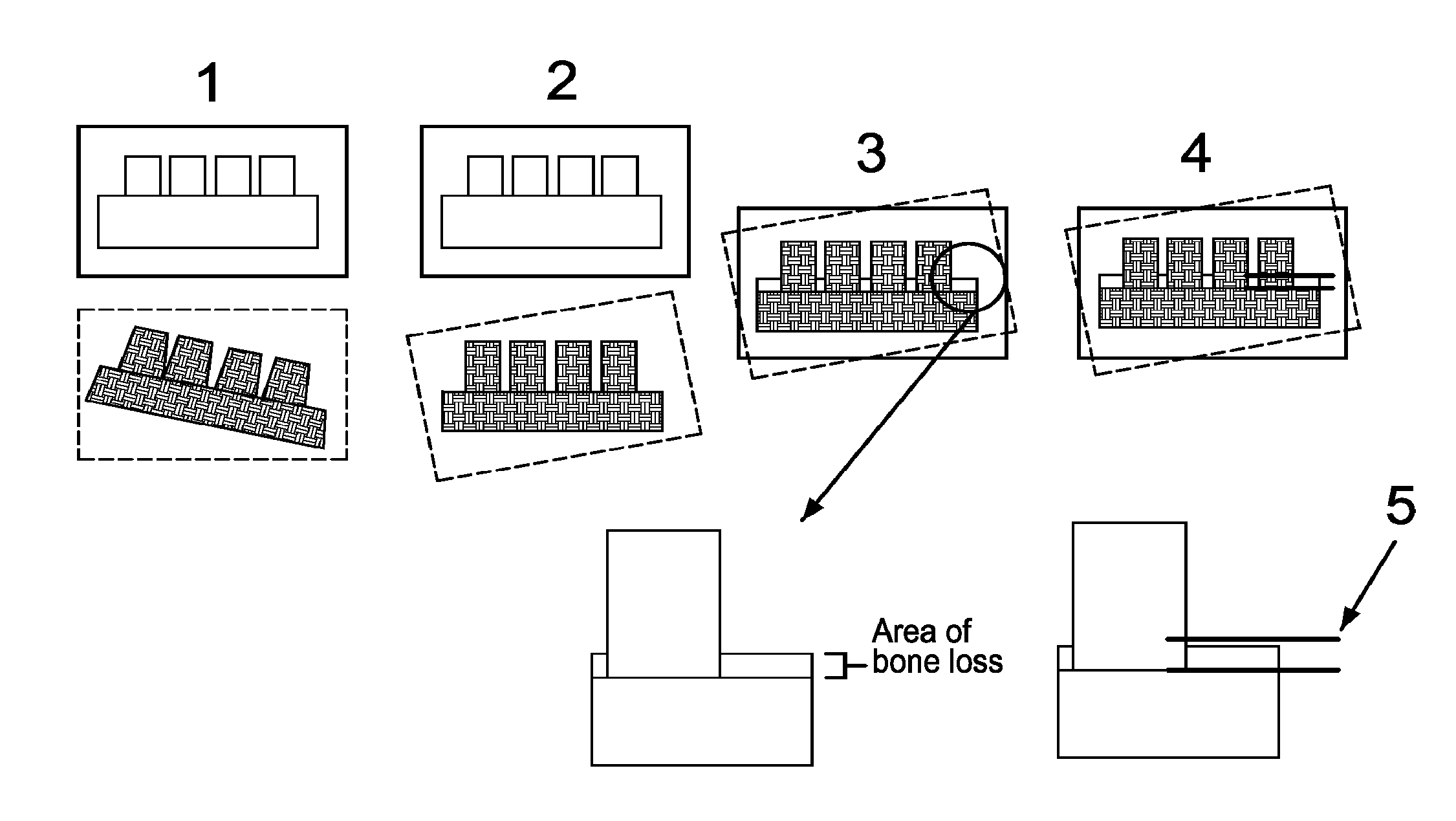 System and method for detecting and tracking change in dental x-rays and dental images