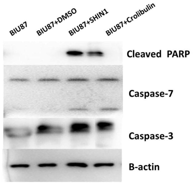 Application of SHMT2 inhibitor in preparation of drugs for inhibiting growth and metastasis of bladder cancer cells