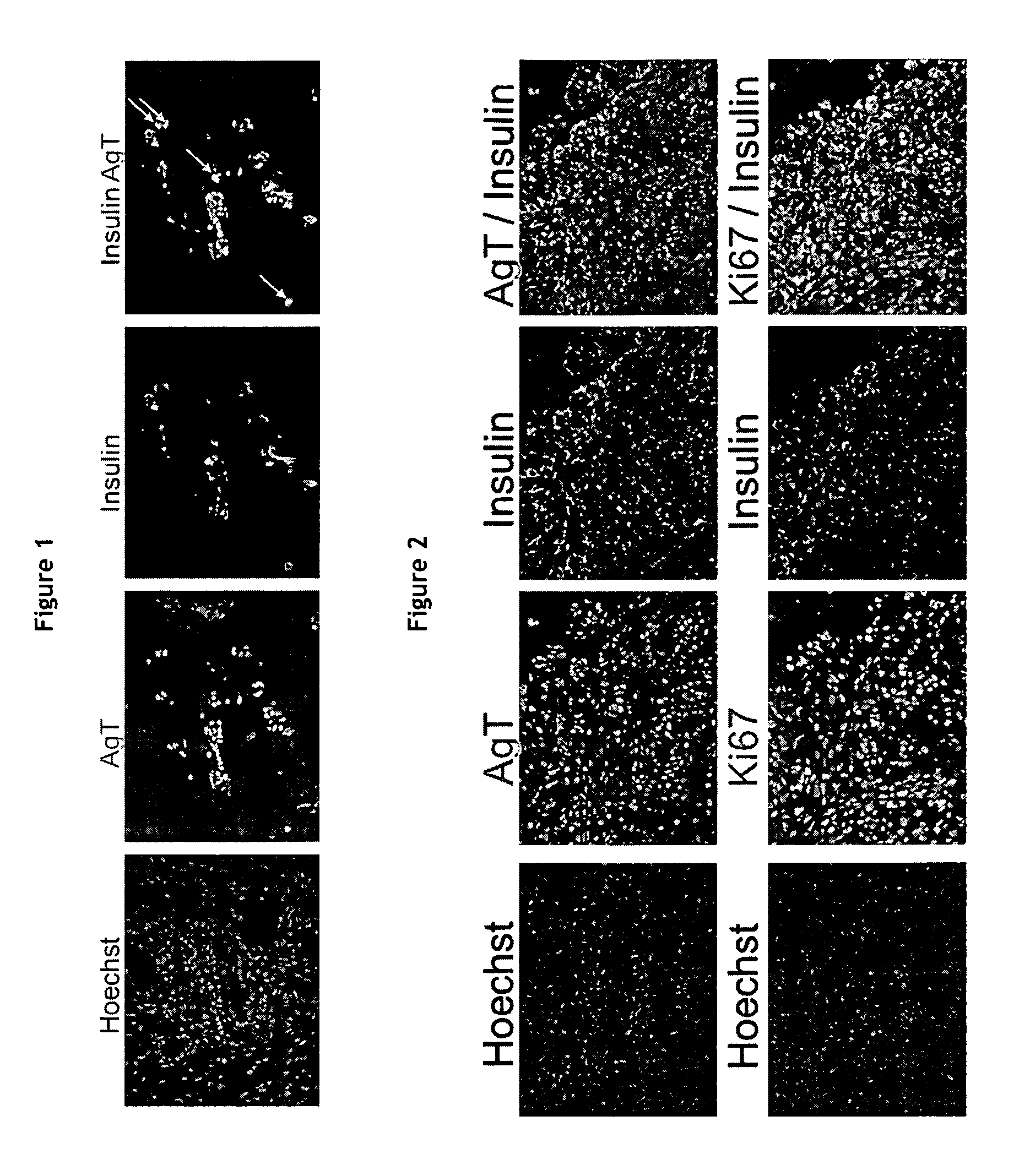 Production of a human beta cell line from an early post natal pancreas