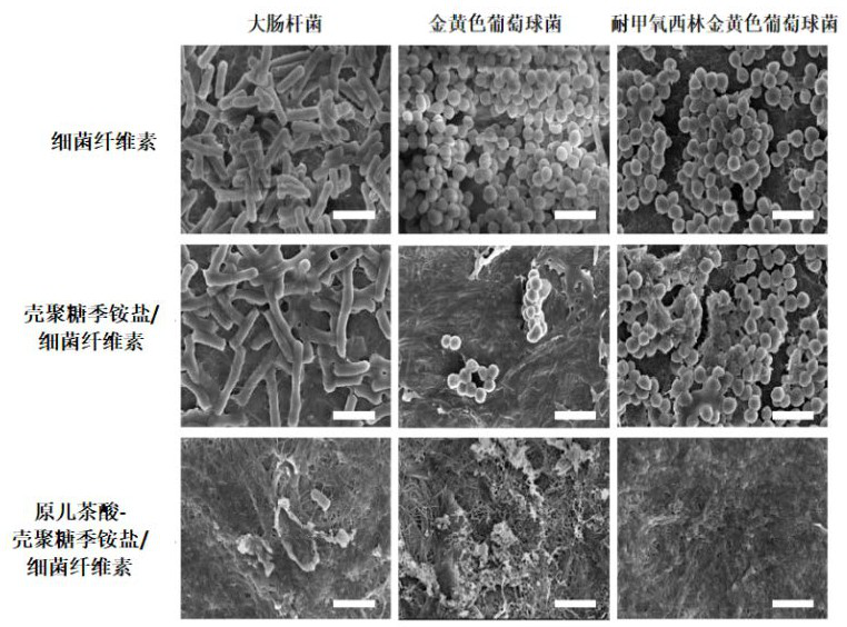Traditional Chinese medicine ingredient modified multifunctional bacterial cellulose-based skin dressing and preparation method thereof