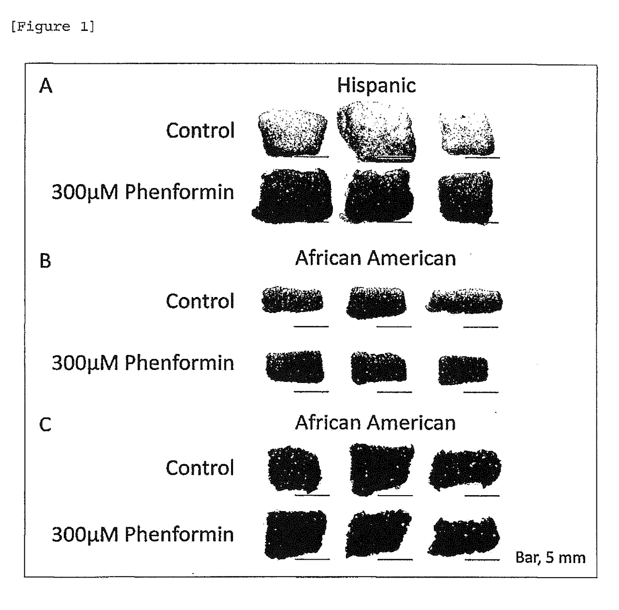 Melanin Decomposition Inhibitor