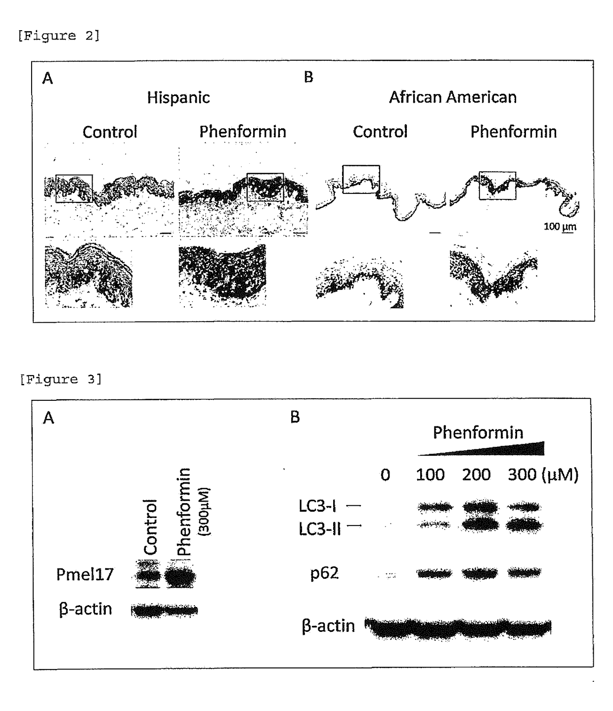 Melanin Decomposition Inhibitor