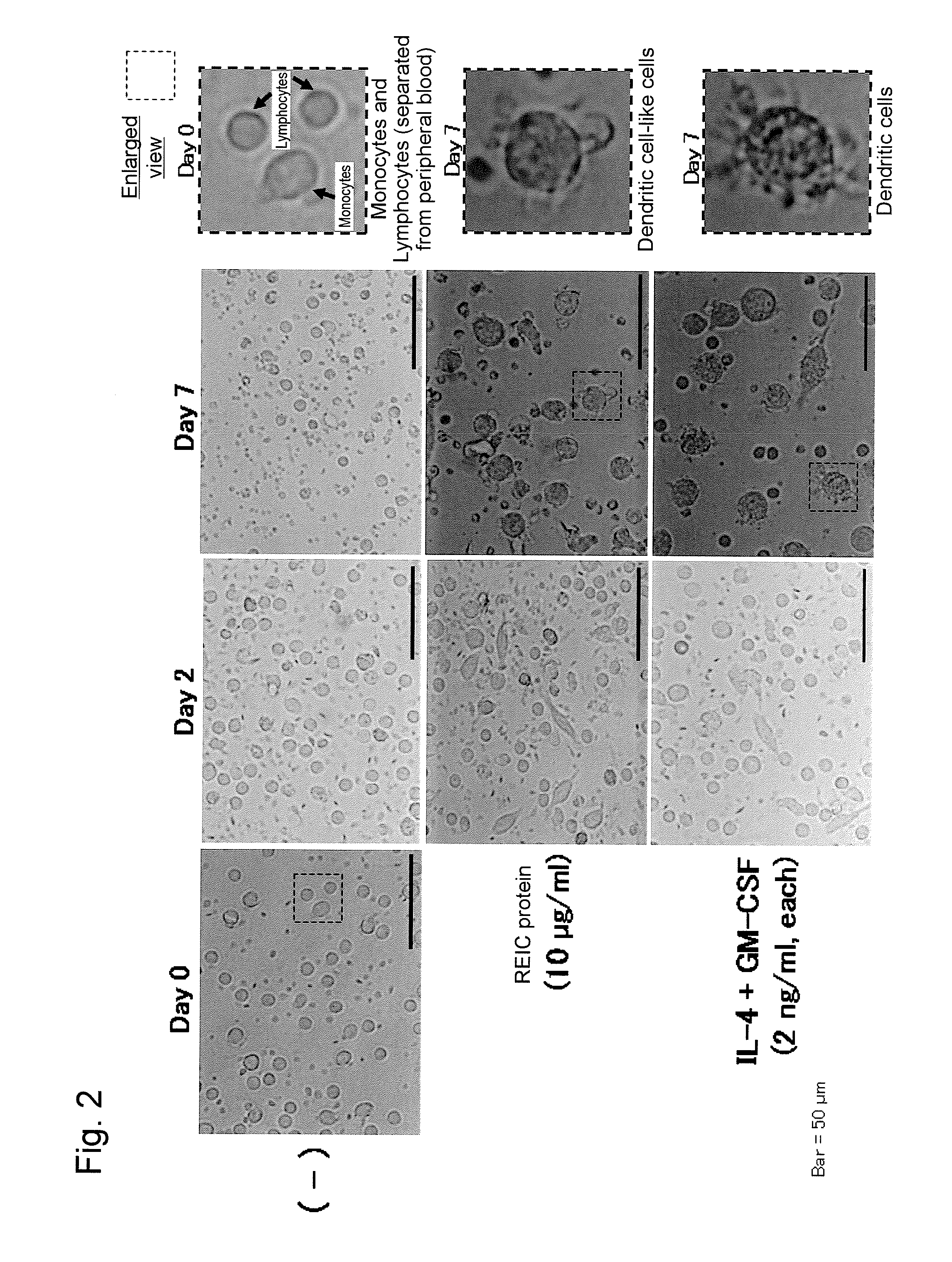 Pharmaceutical composition for treating or preventing cancer by inducing dendritic cell-like differentiation from monocytes to improve anticancer immune activity