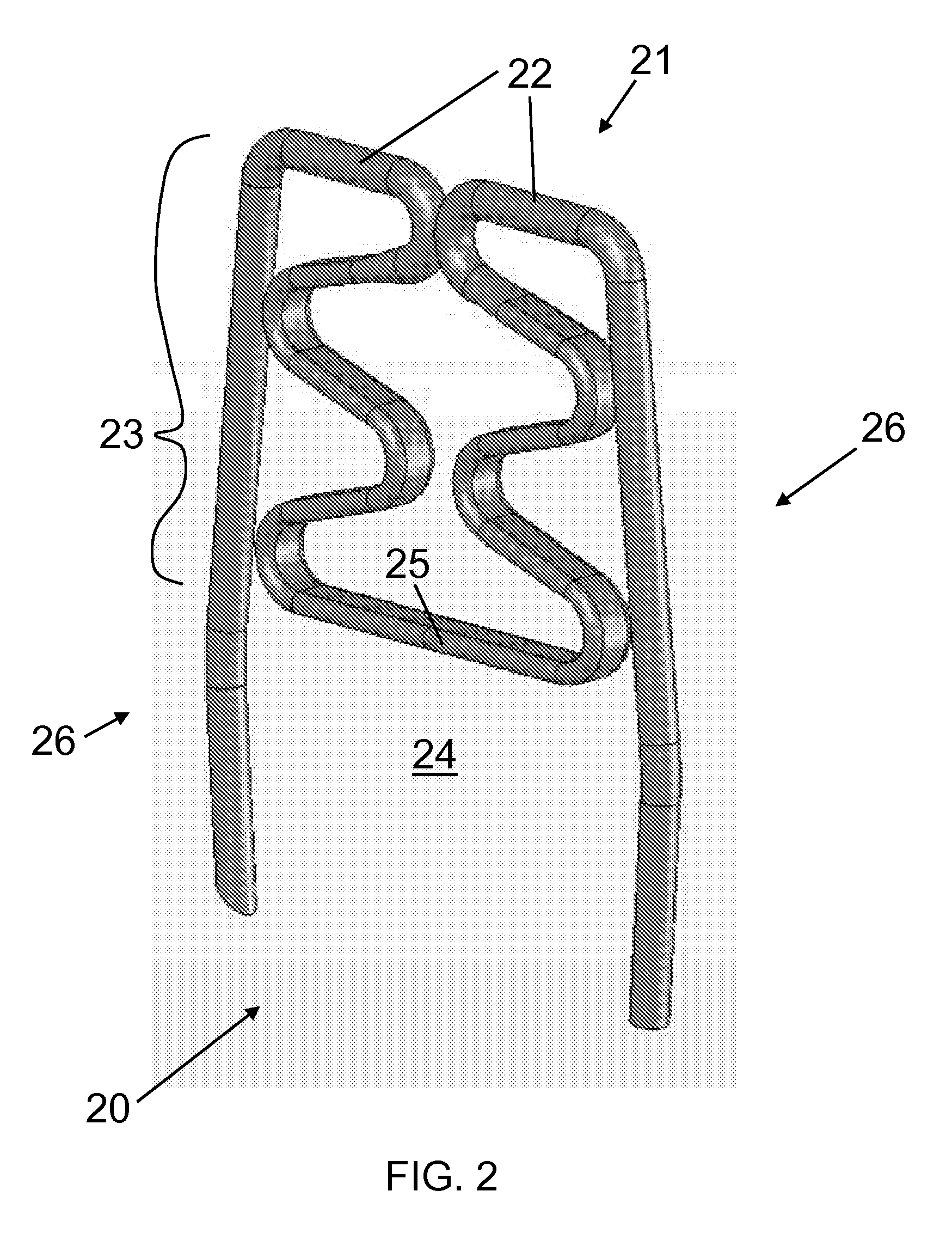 Adjustable Compression Staple and Method for Stapling with Adjustable Compression