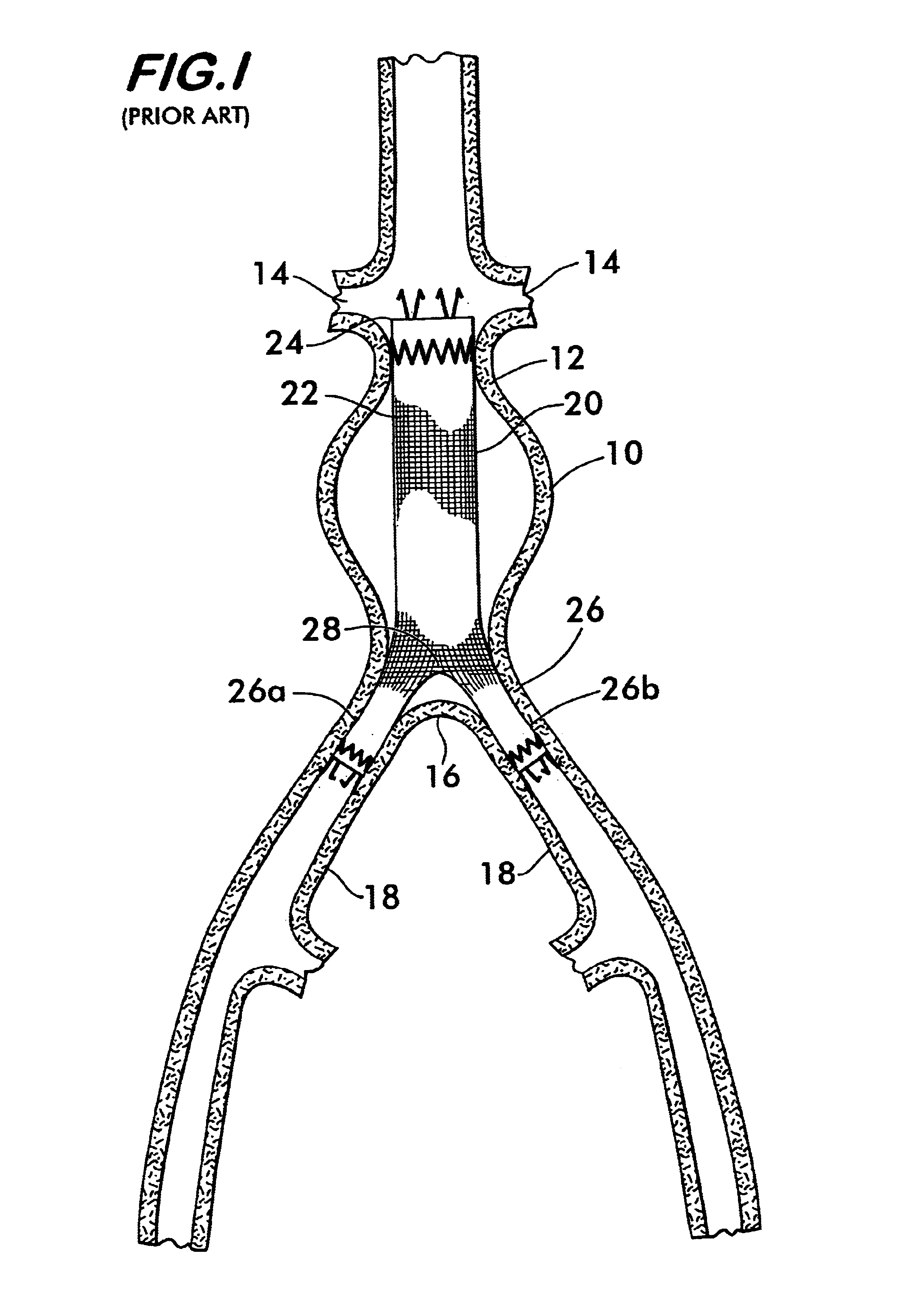 Woven tubular graft with regions of varying flexibility