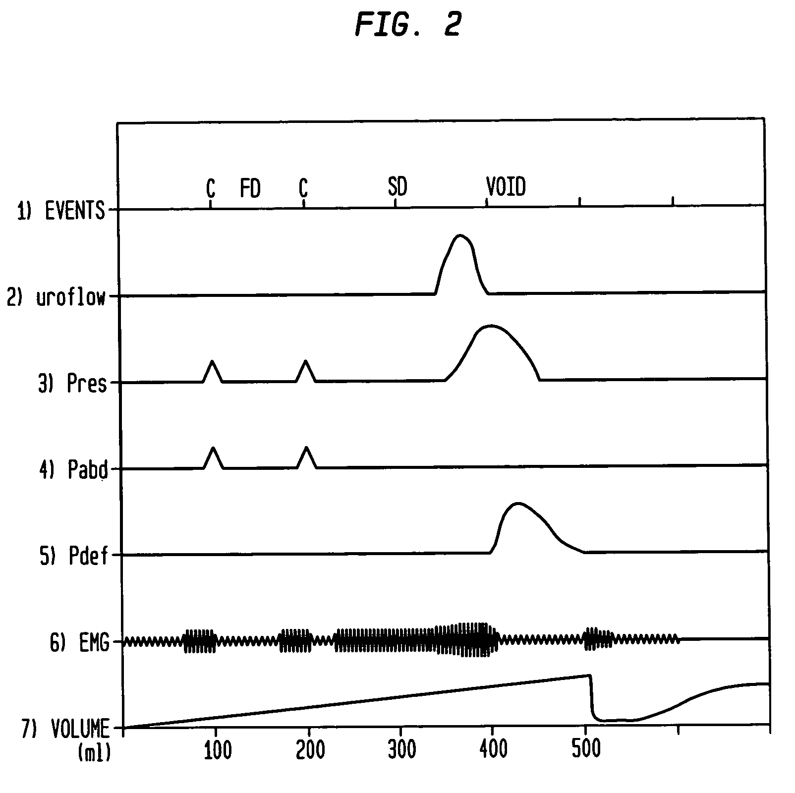 Method and apparatus for measuring bladder electrical activity to diagnose bladder dysfunction