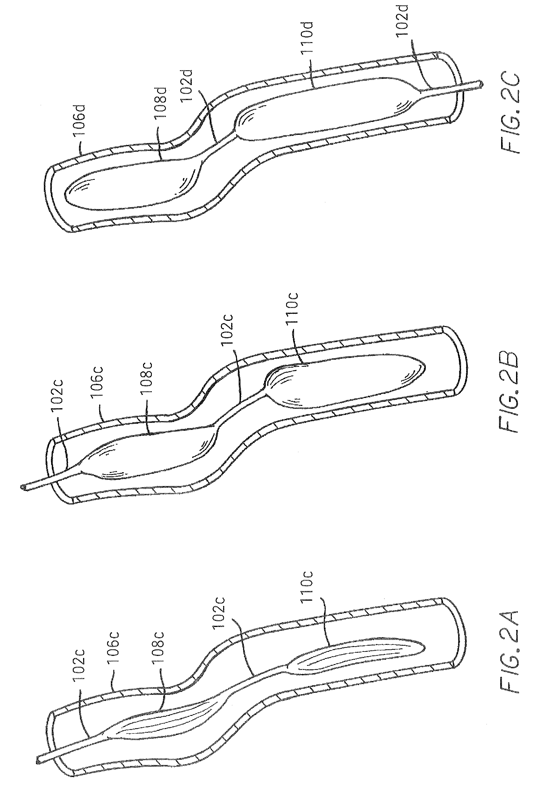 Methods of making aortic counter pulsation cardiac assist devices with three dimensional tortuous shape