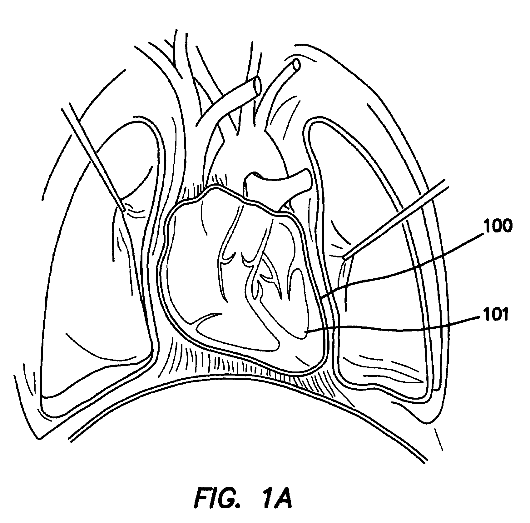 Methods of promoting enhanced healing of tissues after cardiac surgery