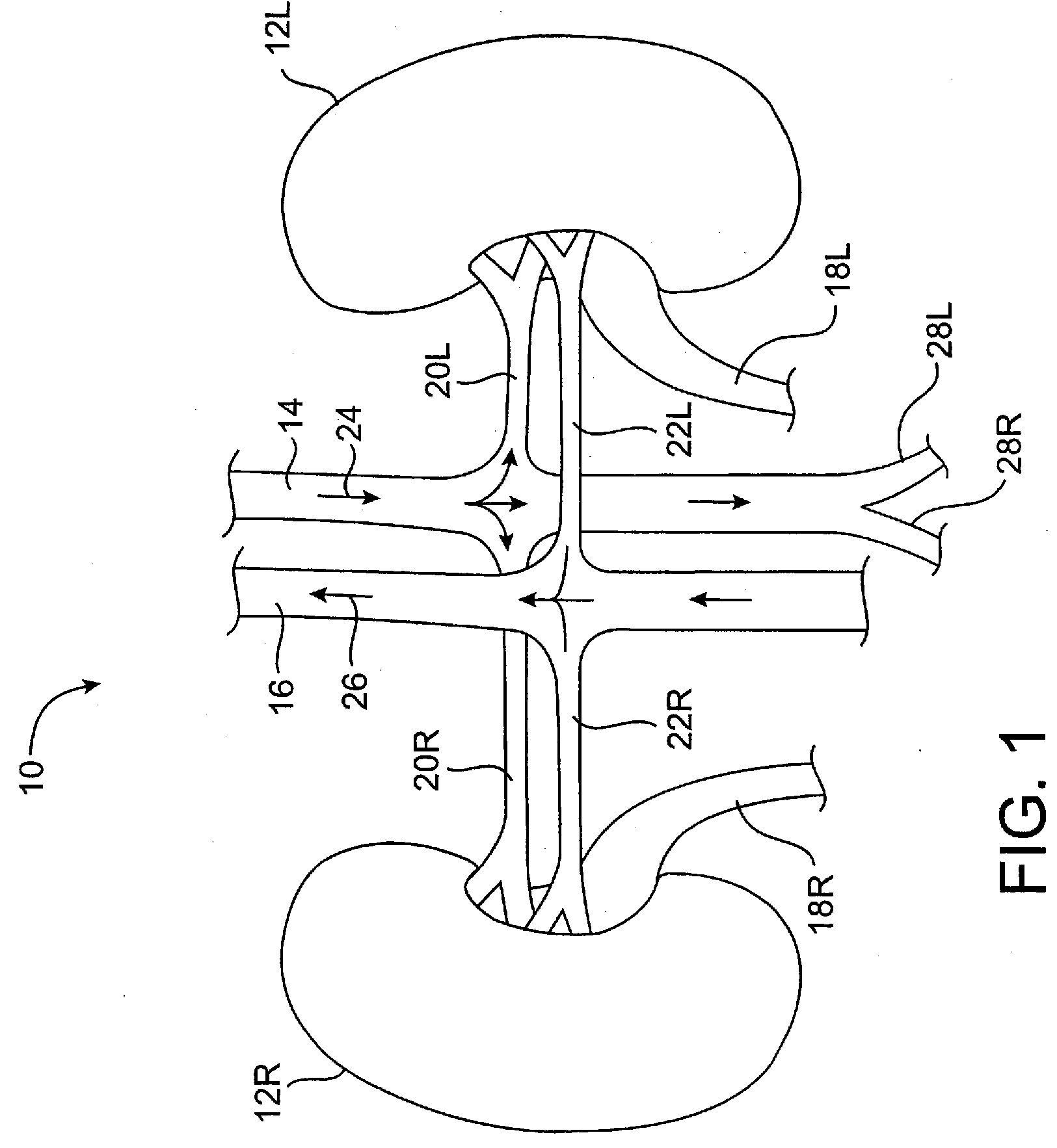 Systems and methods for controlling renovascular perfusion