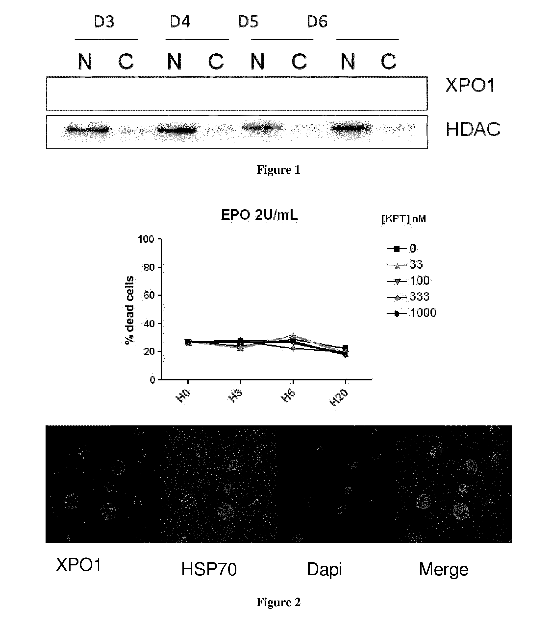 Methods and pharmaceutical compositions for the treatment of beta-thalassemias