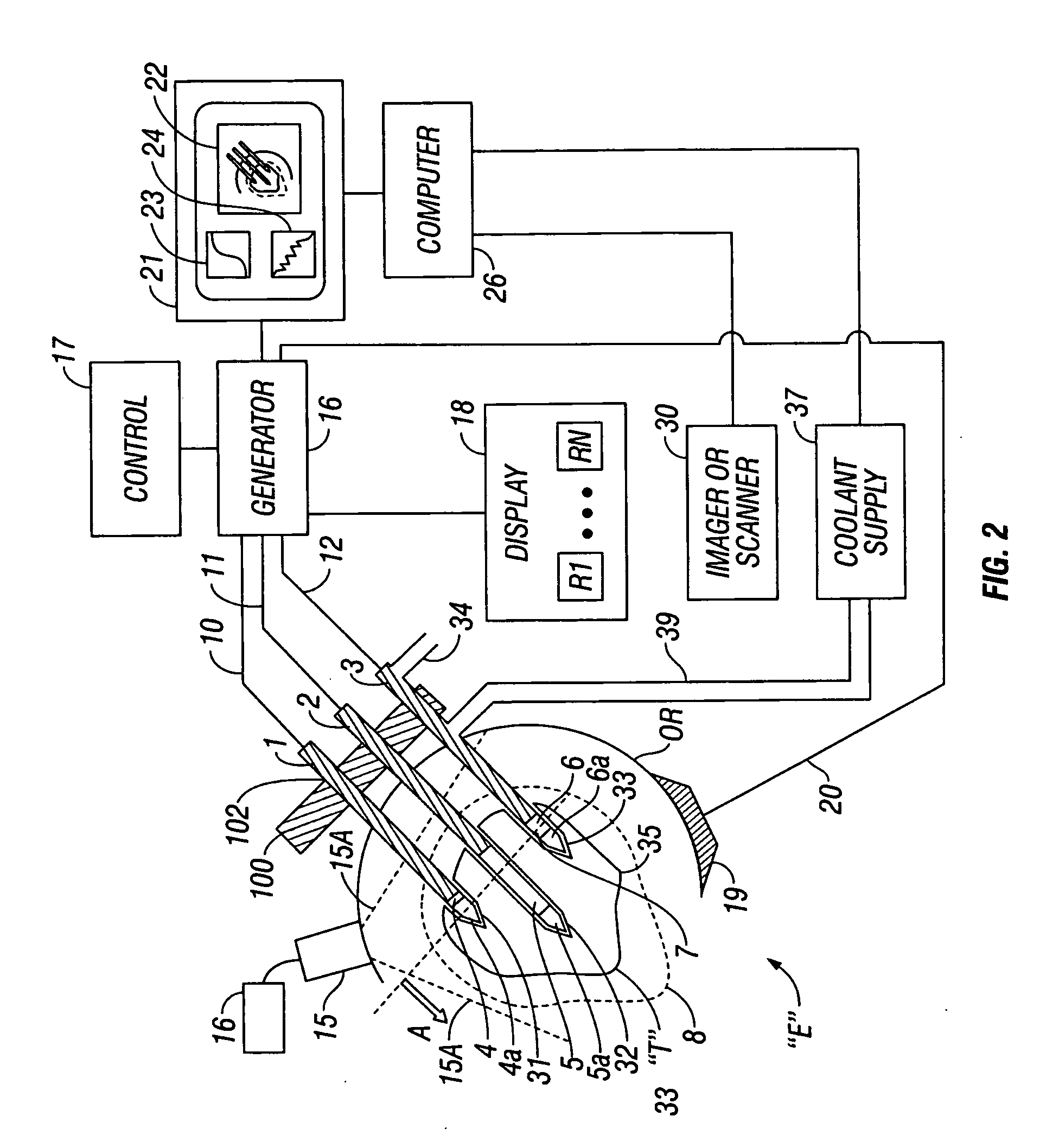 System and method for ablating tissue