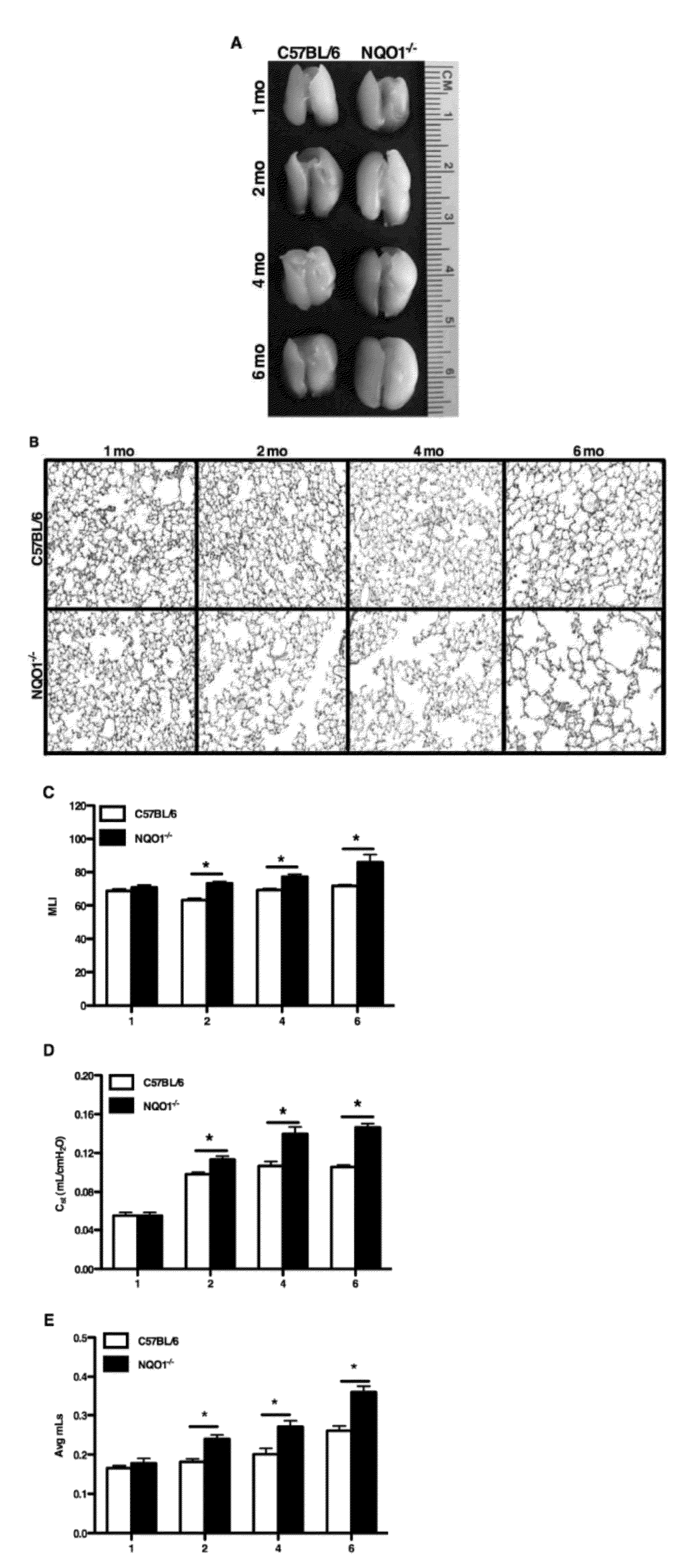 Method for treating lung disease