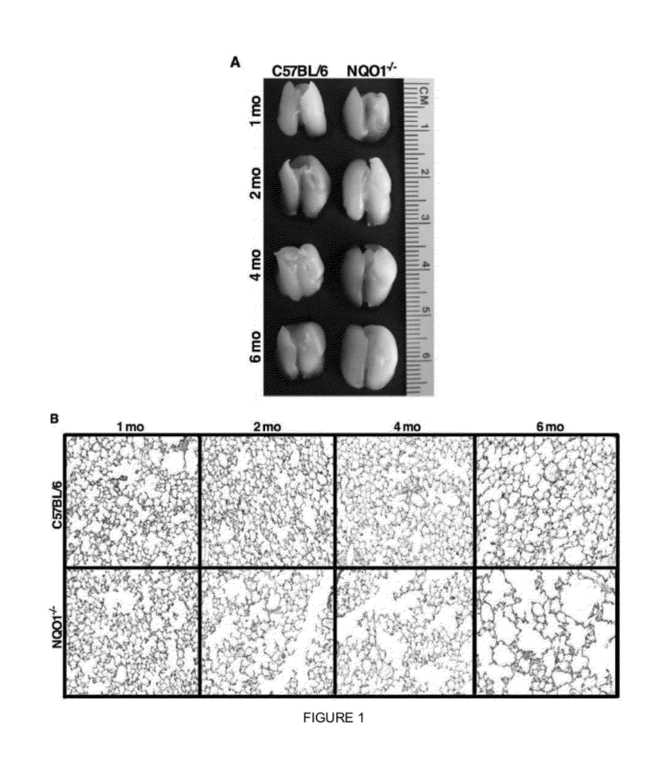 Method for treating lung disease