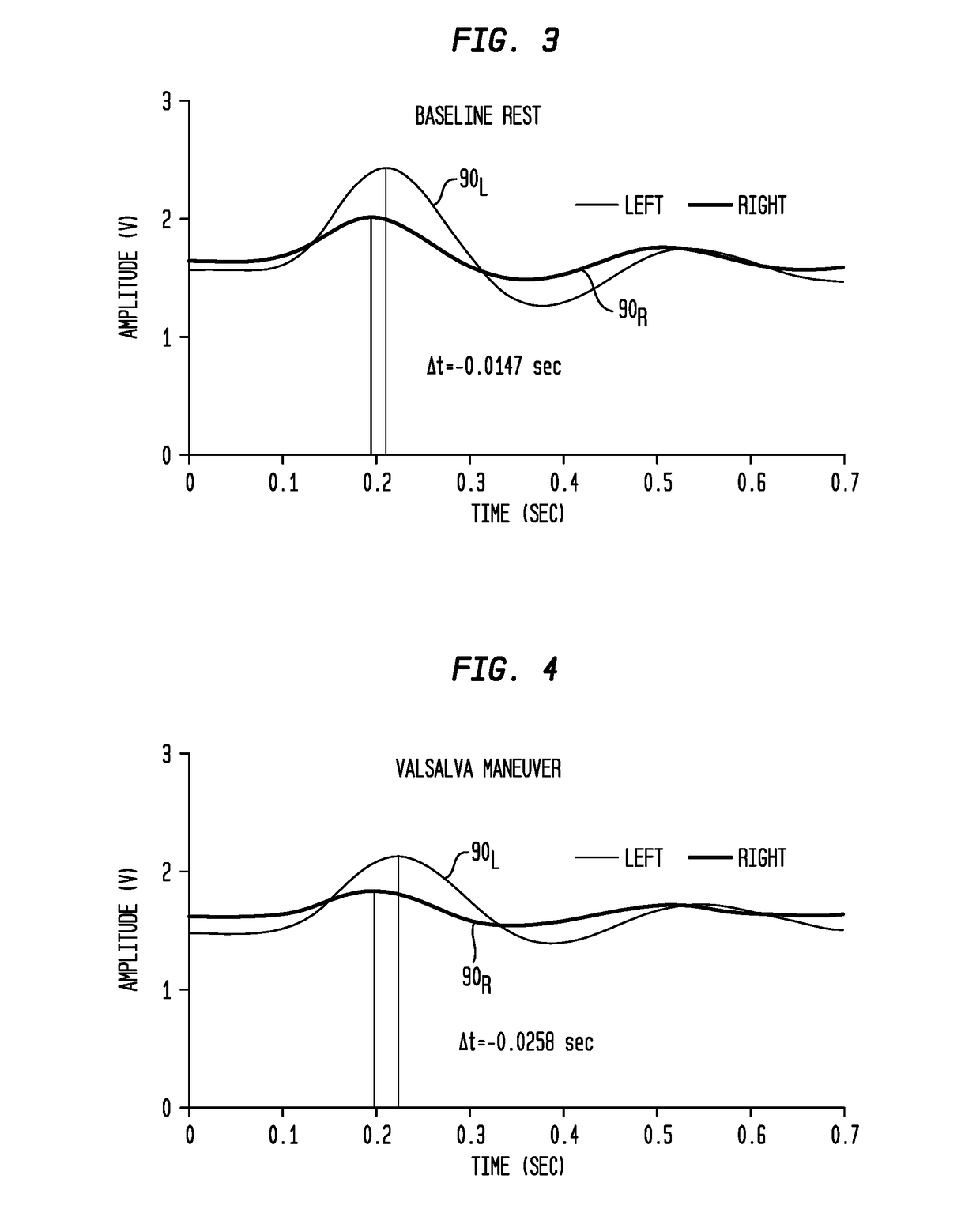 Ambulatory Blood Pressure and Vital Sign Monitoring Apparatus, System and Method