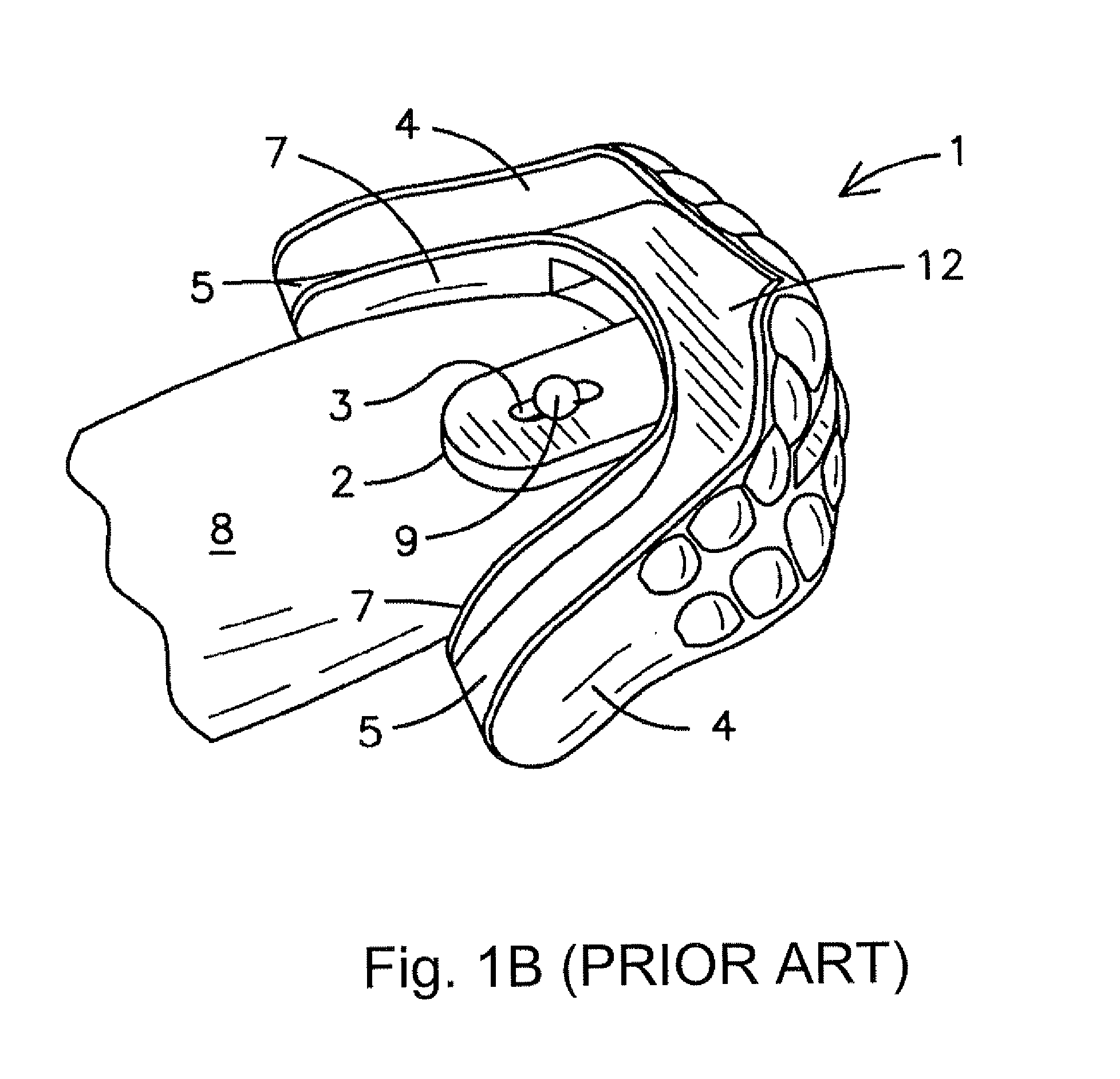 Oral tongue positioning device