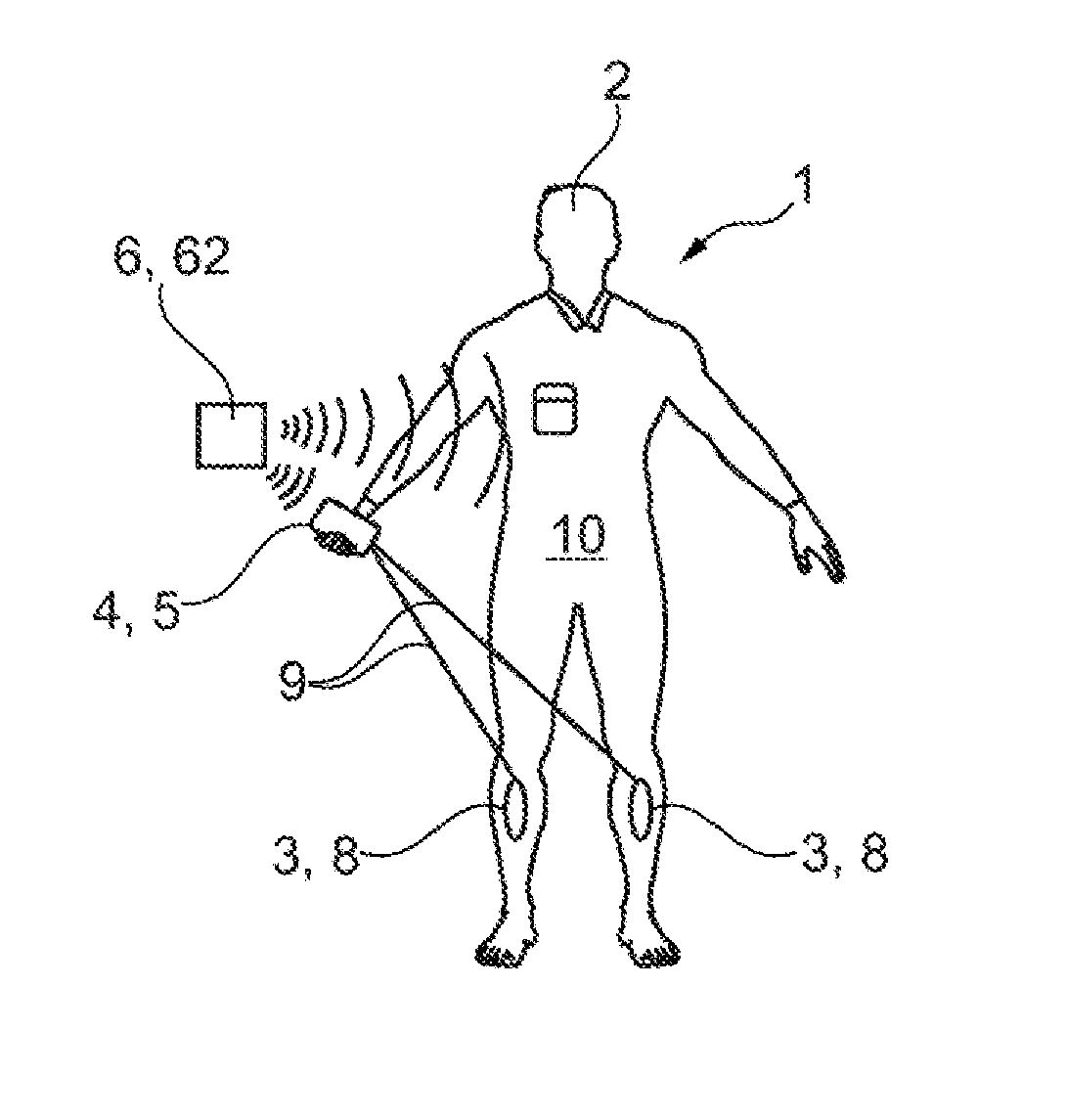 System for controlling stimulation impulses