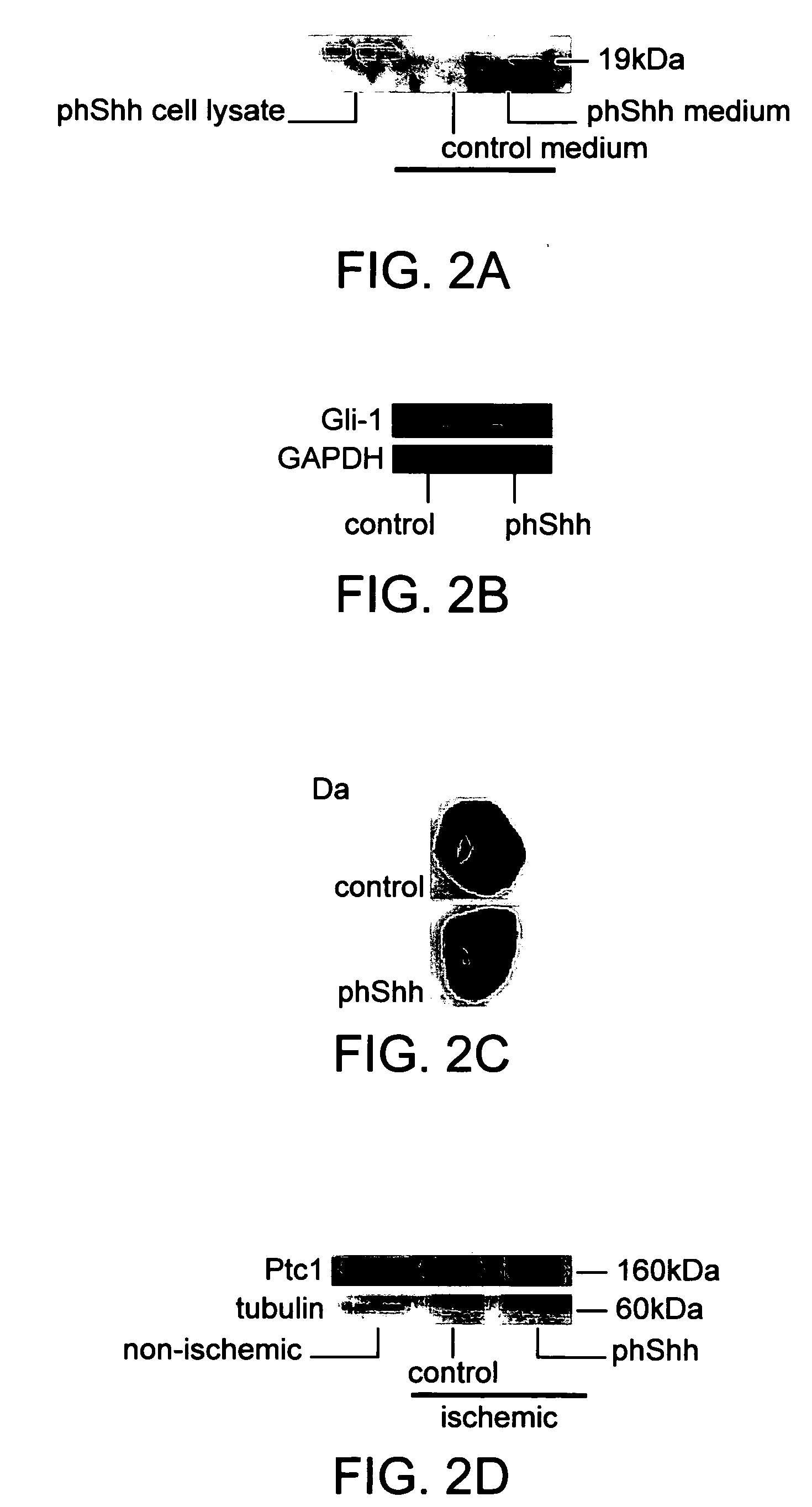Morphogen compositions and methods of use thereof to treat heart disorders