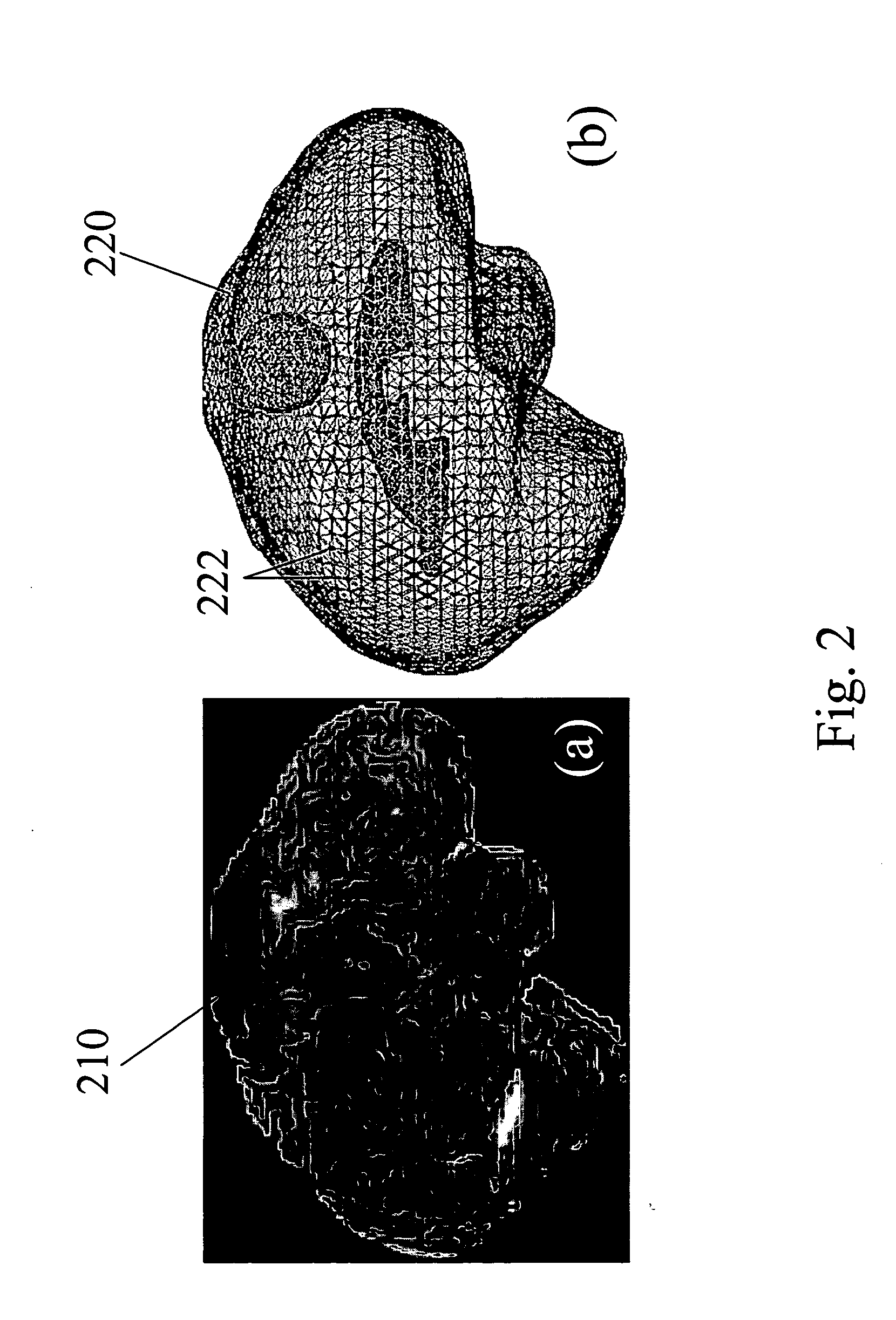 Apparatus and methods of brain shift compensation and applications of the same