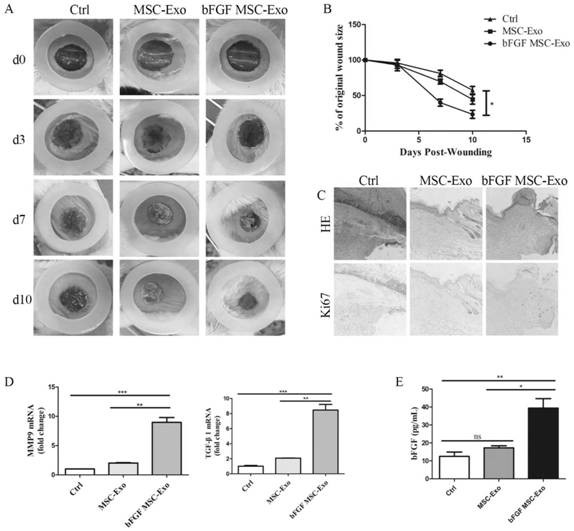 bFGF mesenchymal stem cell exosome as well as preparation method and application thereof