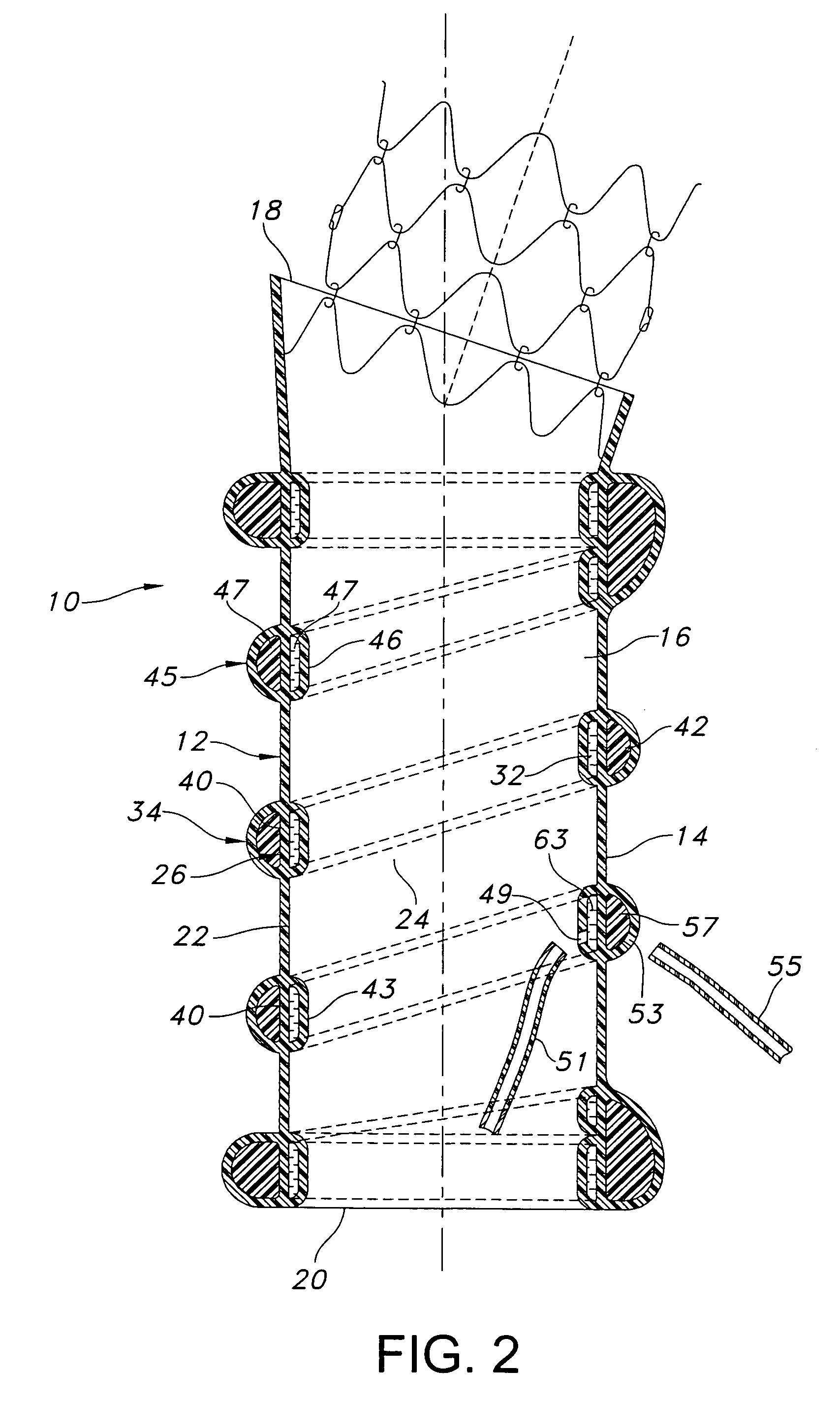 Dual chamber cuff structure