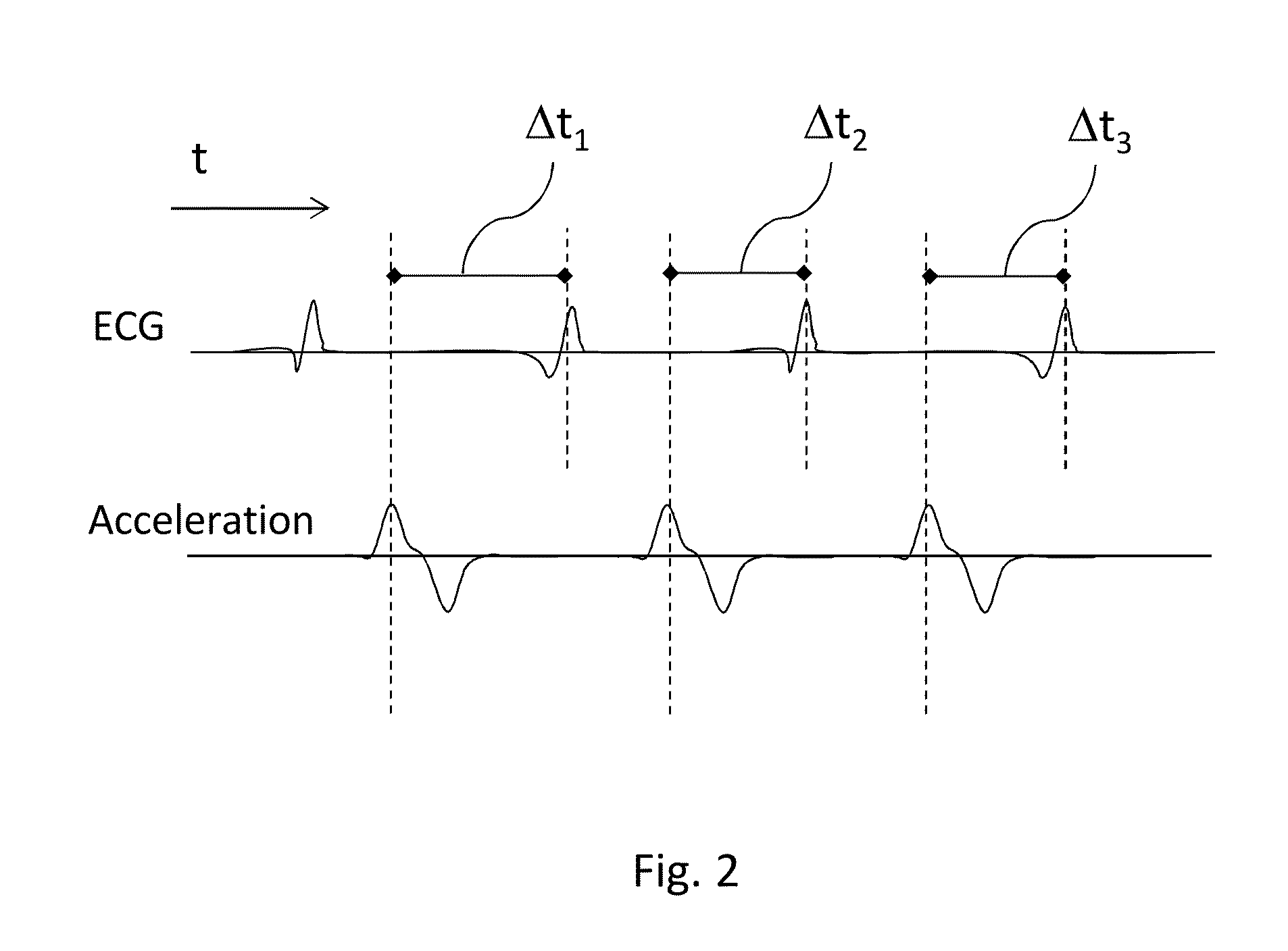 Wearable sports monitoring equipment and method for characterizing sports performances or sportspersons