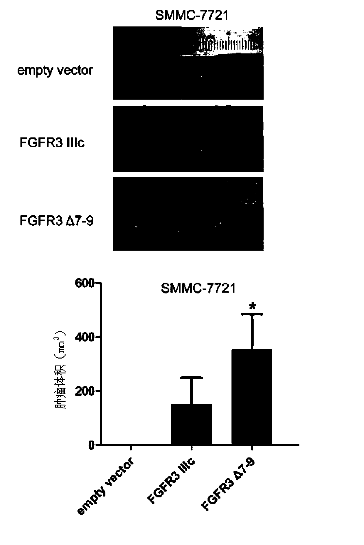 Novel splice variant of FGFR3 (Fibroblast Growth Factor Receptor 3) in liver carcinoma tissue and application thereof