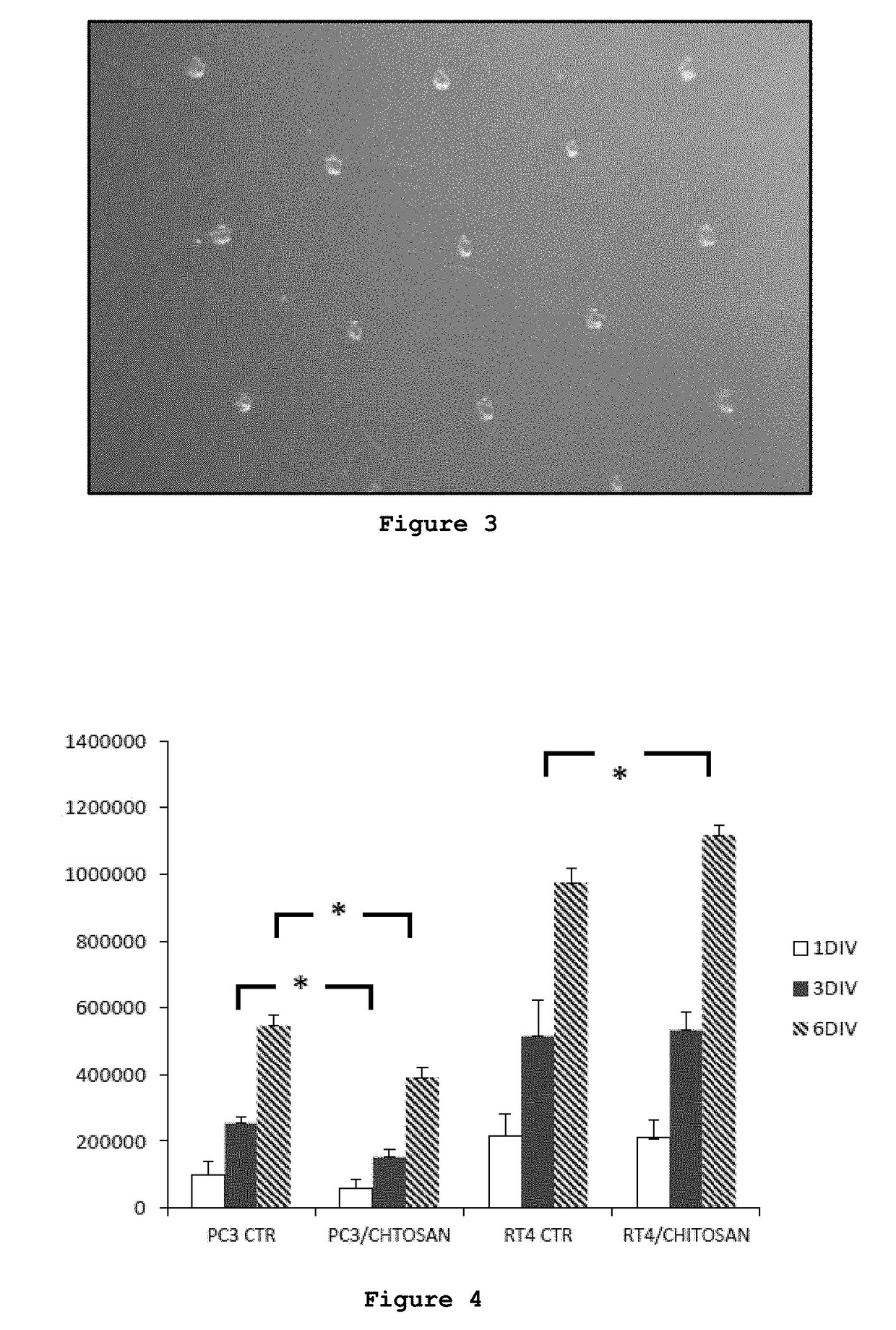 Composition comprising chitosan for use in the prevention and/or in the treatment of incontinence and/or impotence in a subject undergoing prostatectomy