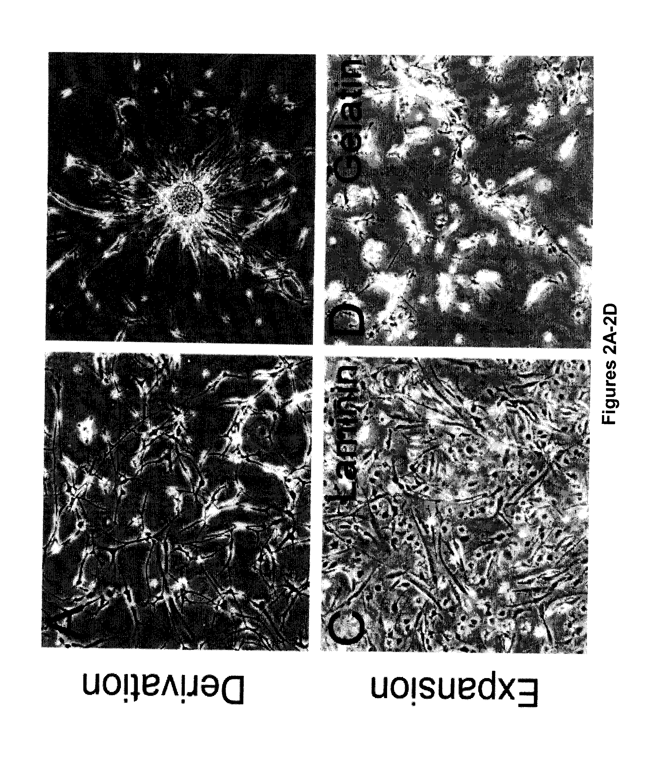 Neural tumor stem cells and methods of use thereof