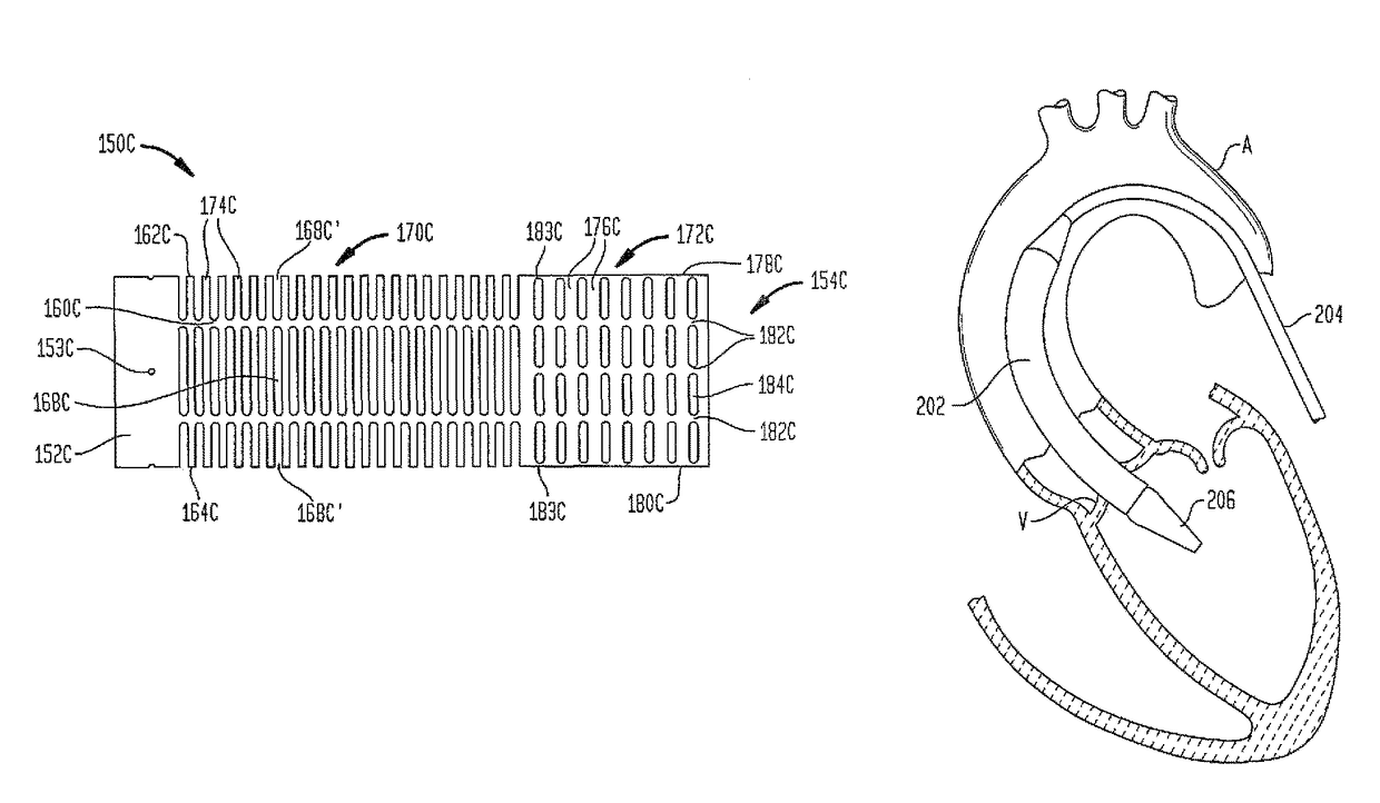 Delivery system for collapsible heart valve