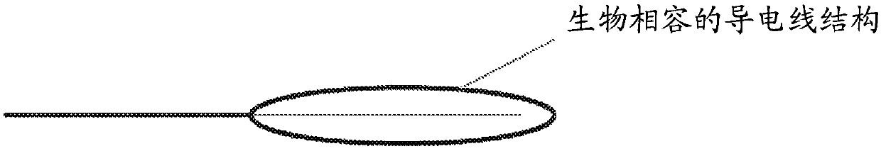 Radio frequency electro-thrombectomy device