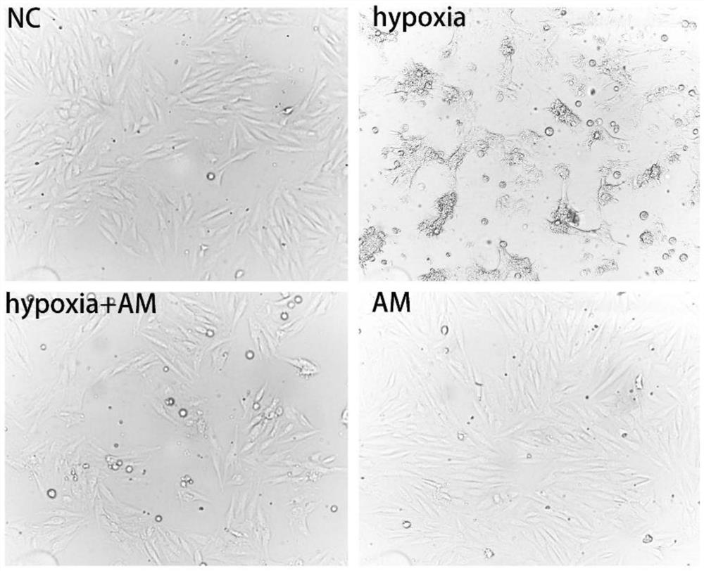 Application of agrimonolide in antagonizing myocardial cell injury caused by hypoxia