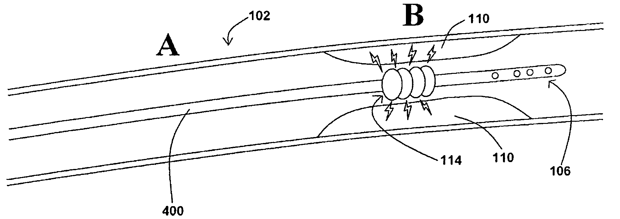 Devices, systems, and methods for removing stenotic lesions from vessels
