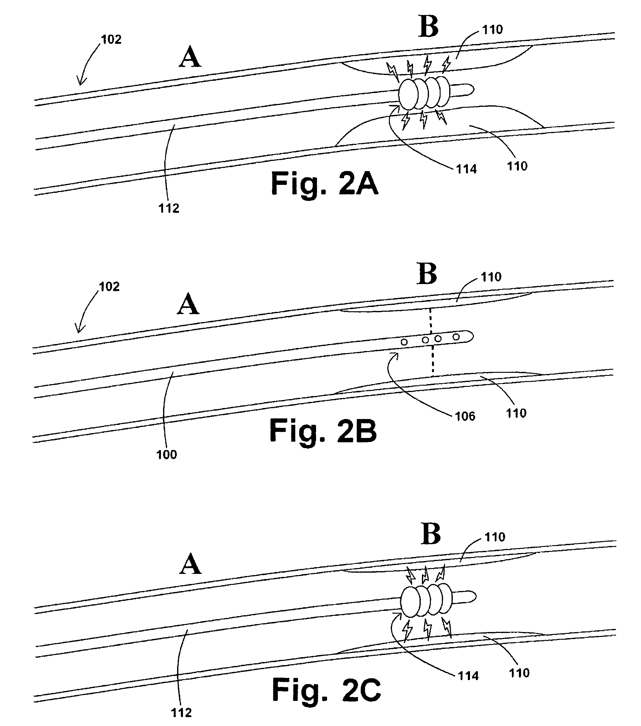 Devices, systems, and methods for removing stenotic lesions from vessels
