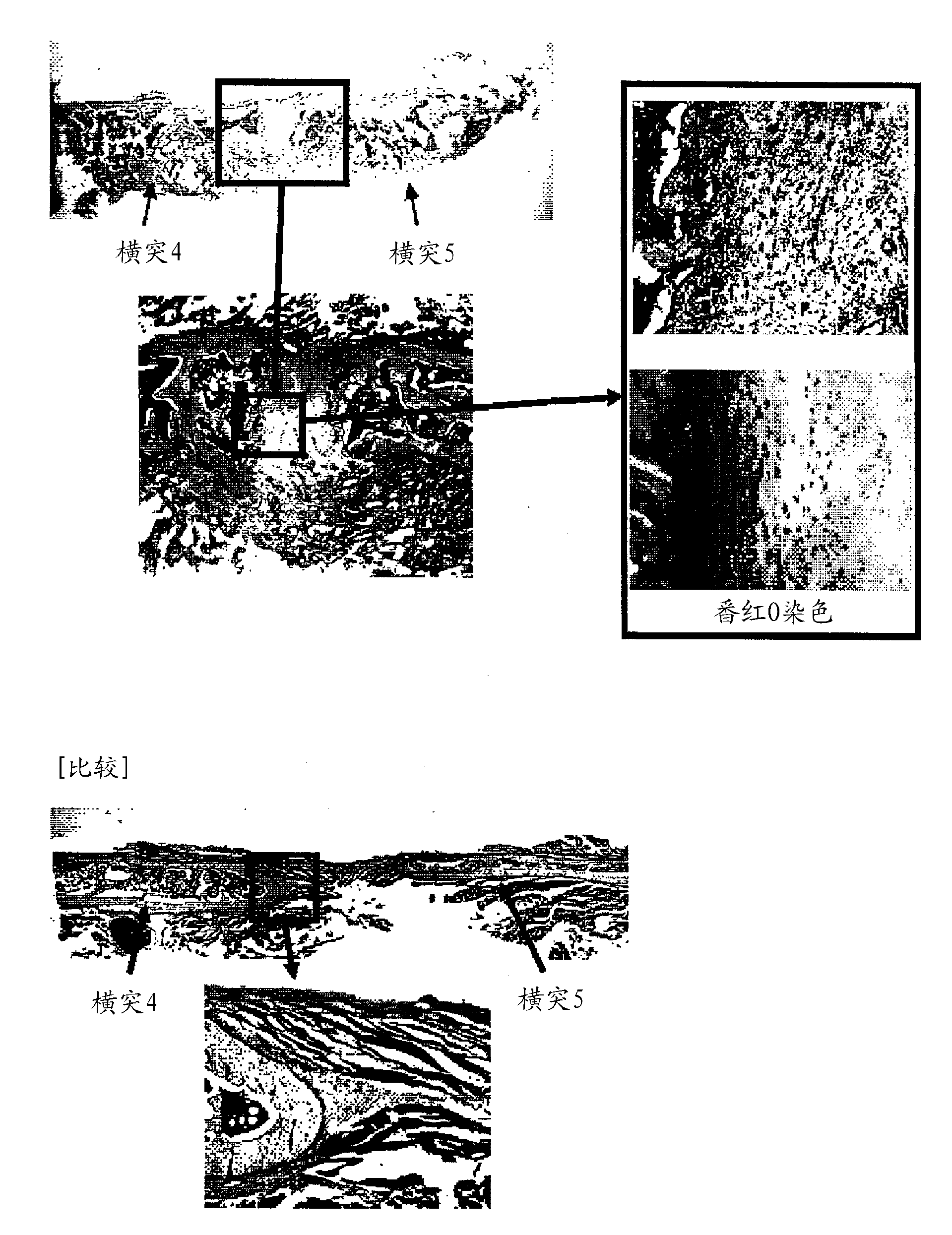 Material for induction of hard tissue regeneration