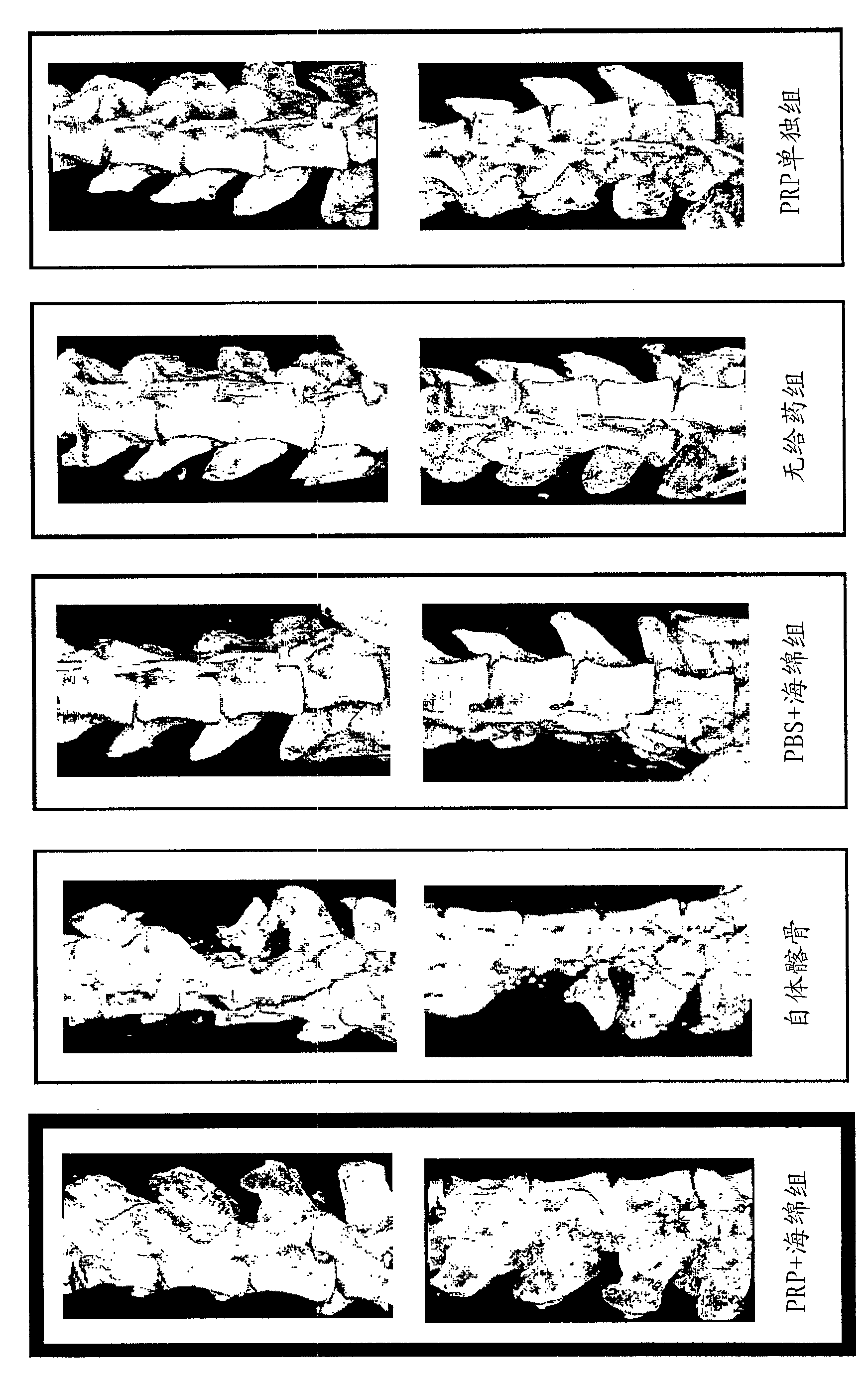 Material for induction of hard tissue regeneration