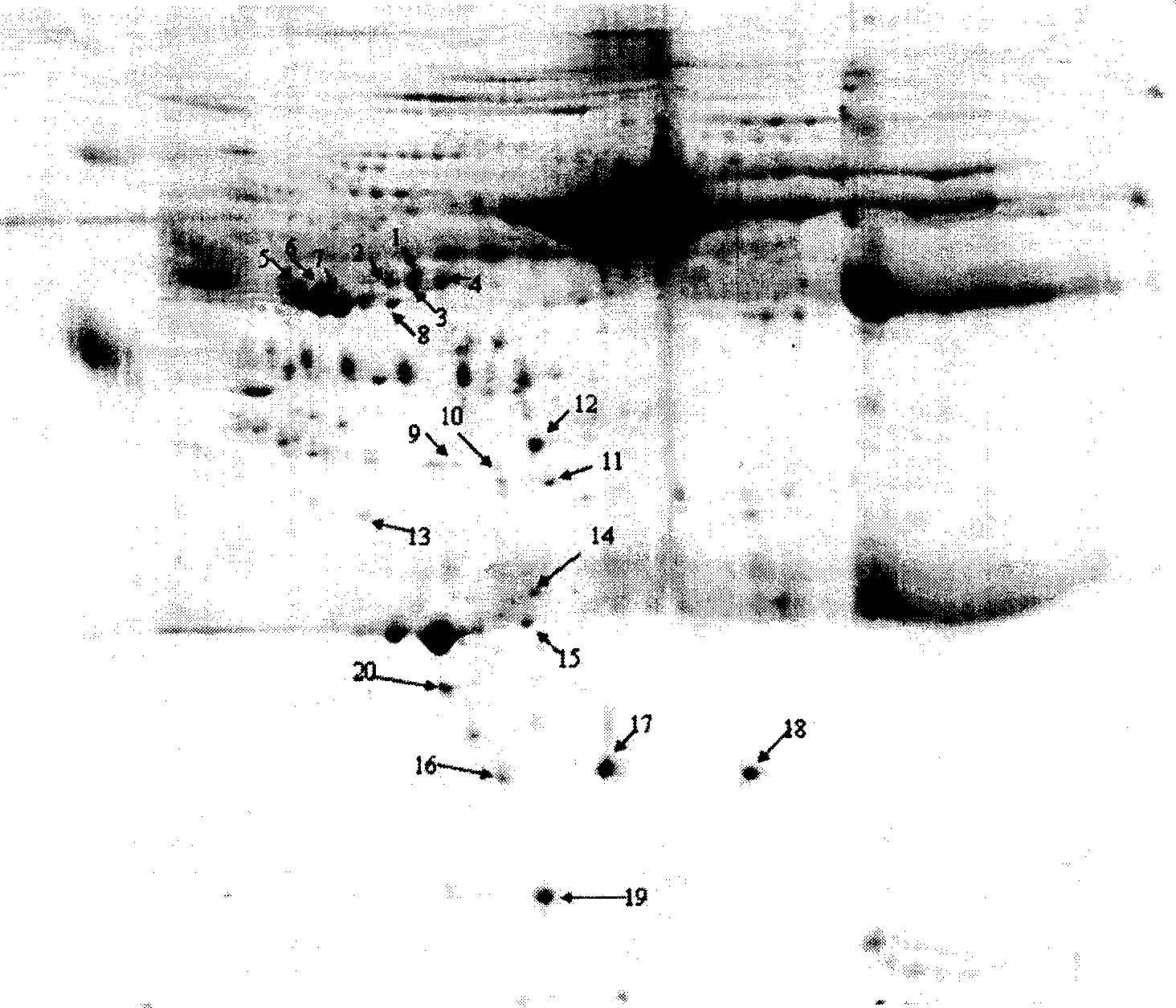 Method for acquiring plasma specific protein for schizophrenia diagnosis and use thereof