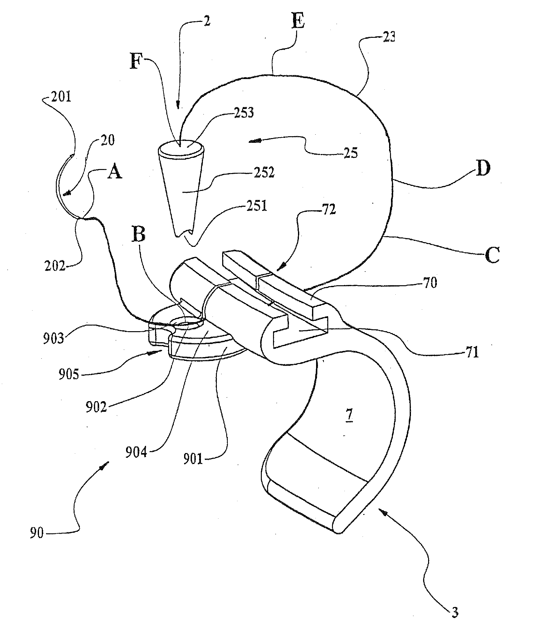 Suture retention device