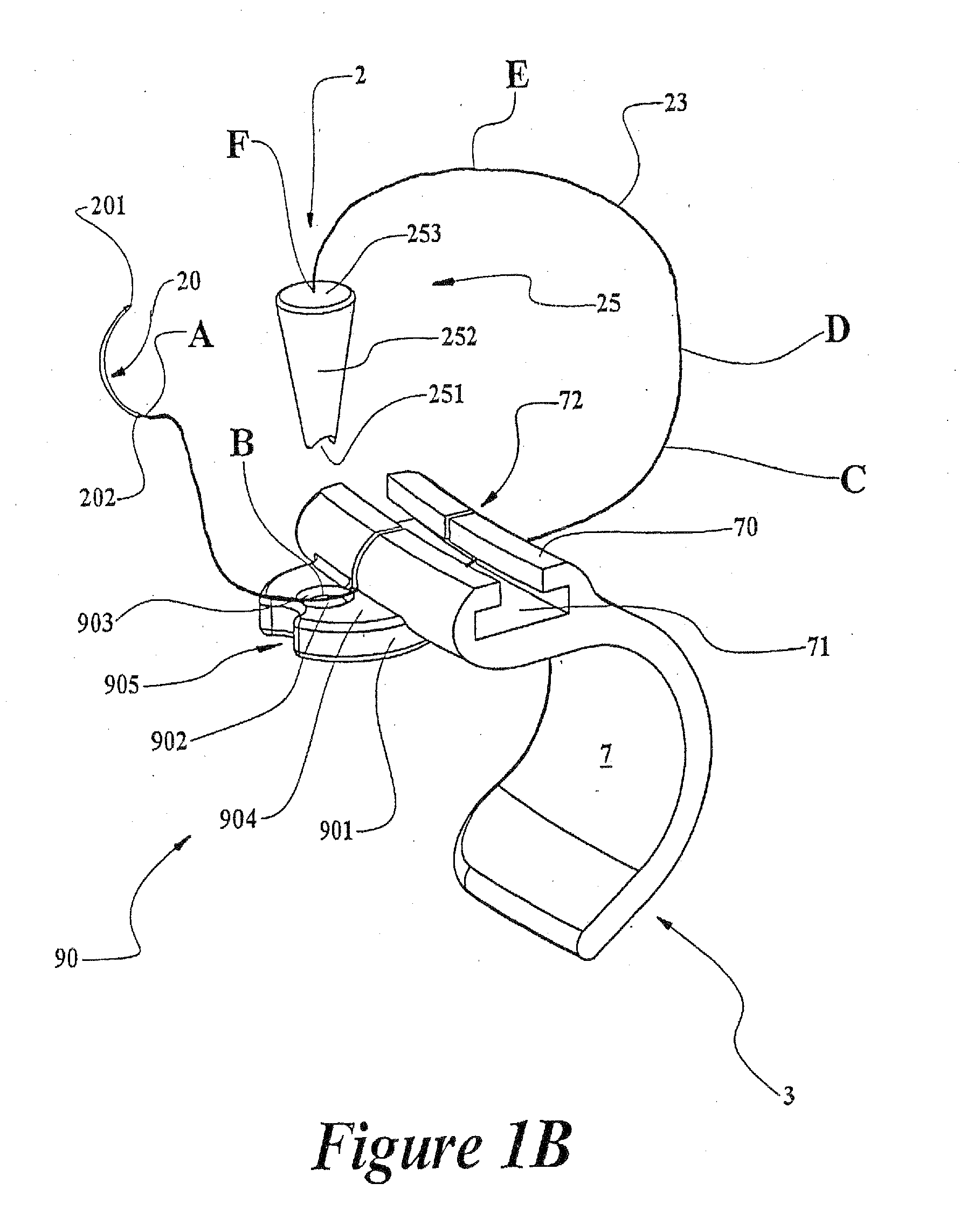 Suture retention device