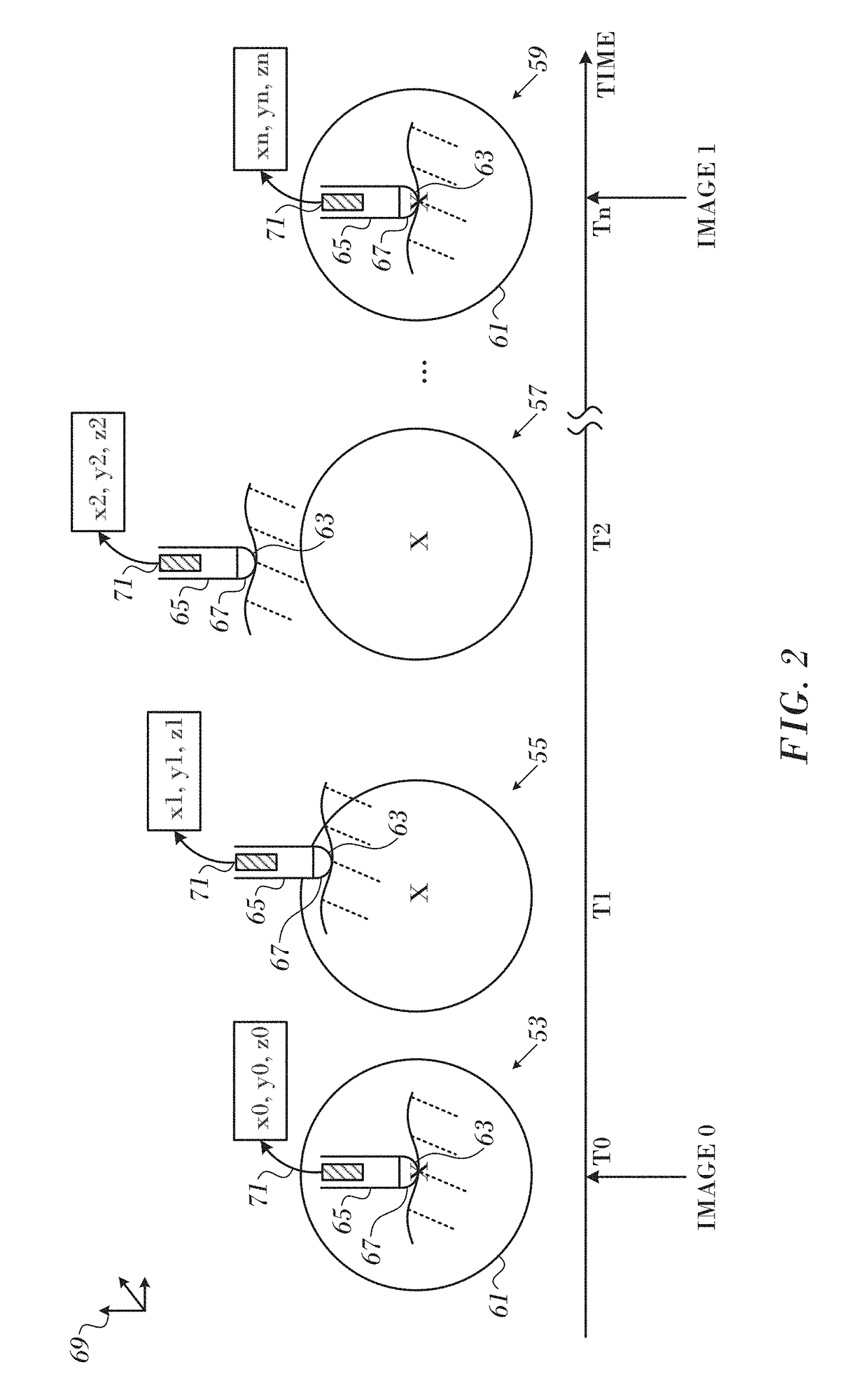 Magnetic resonance thermometry during ablation