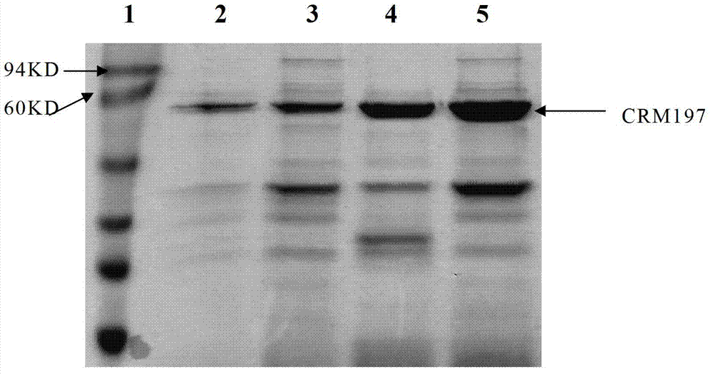 Expression vector stably replicated in corynebacterium diphtheriae and corynebacterium diphtheriae with expression vector