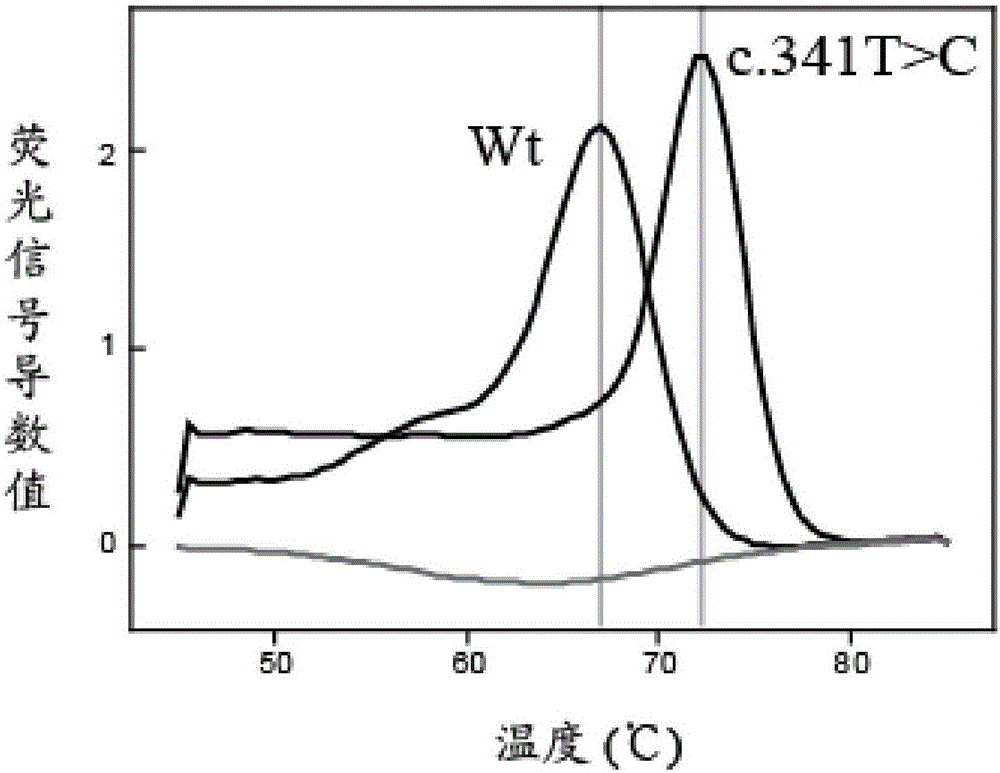 NAT2 gene polymorphism fluorescence PCR melting curve detection kit