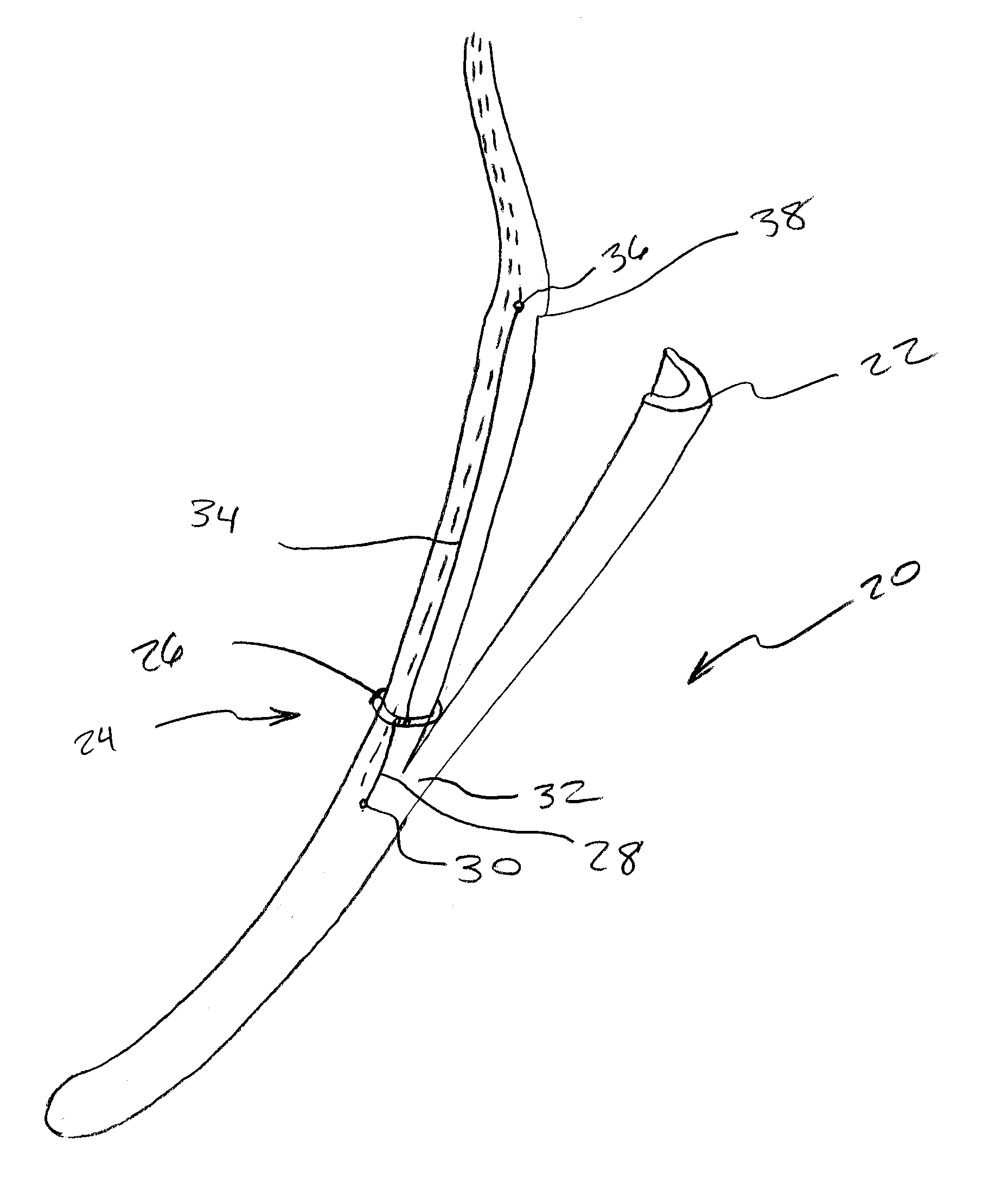 Methods And Devices For Performing Gastroplasty