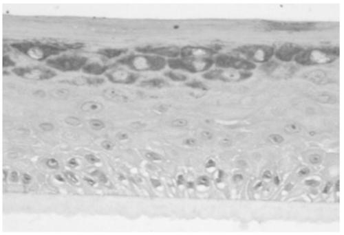 In vitro recombinant human skin epidermis model and its preparation method and application