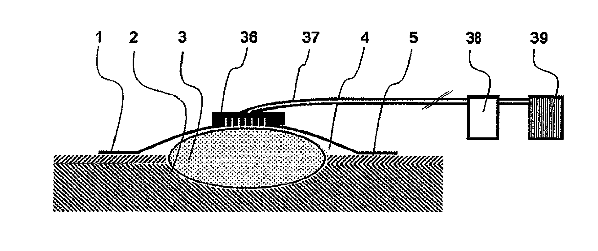 Method for vacuum therapy of wounds