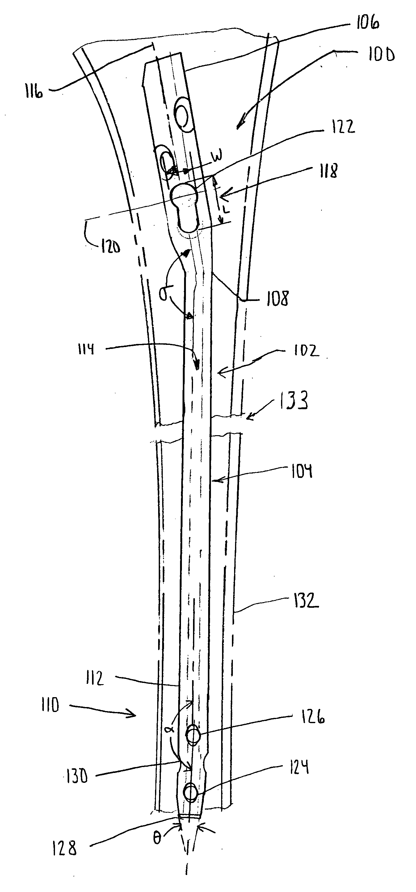 Intramedullary nail and associated method