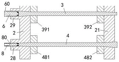 Anti-wear bracket bearing and locking assembly